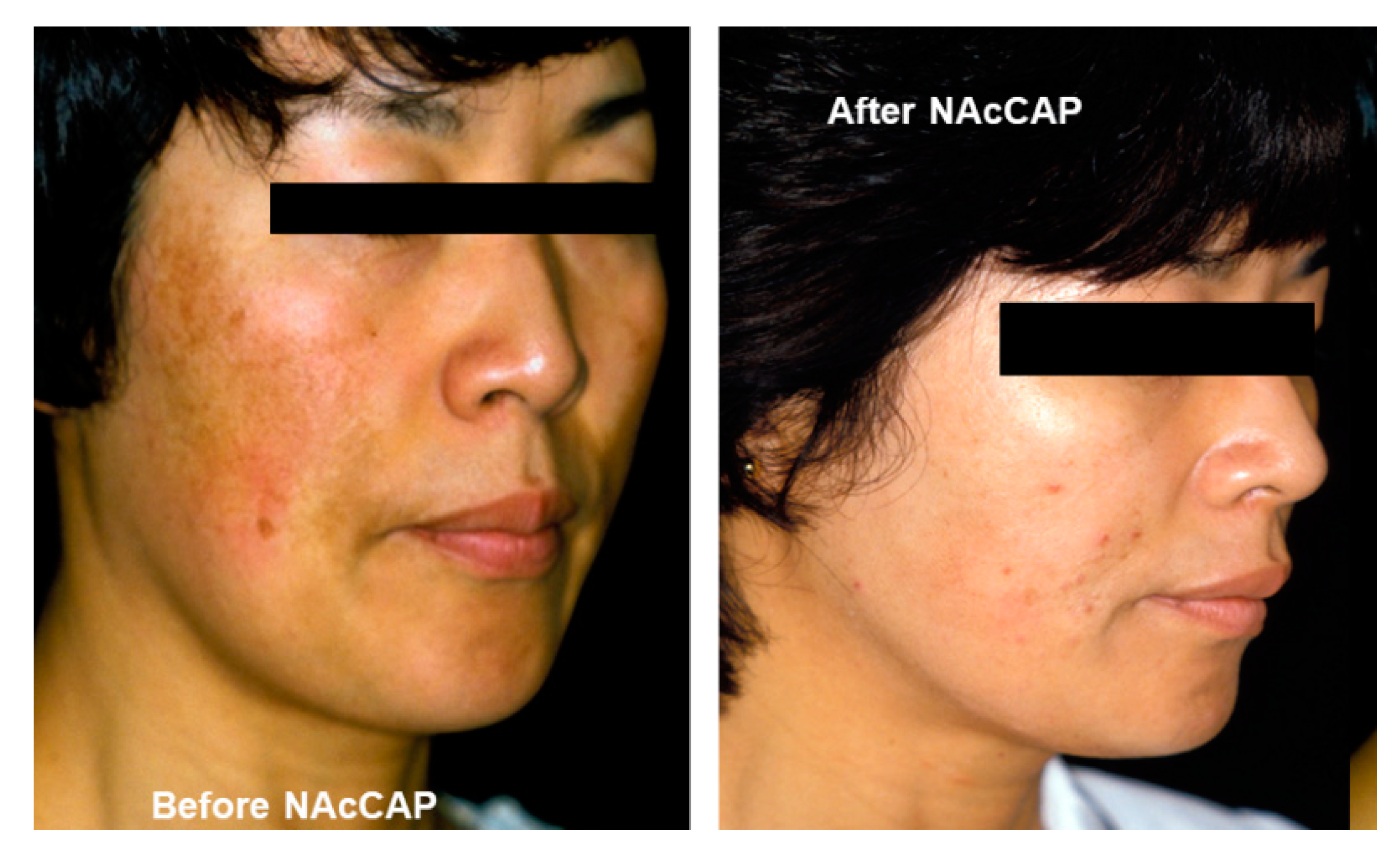 Ijms 21 06129 g007 Ijms 21 06129 g007