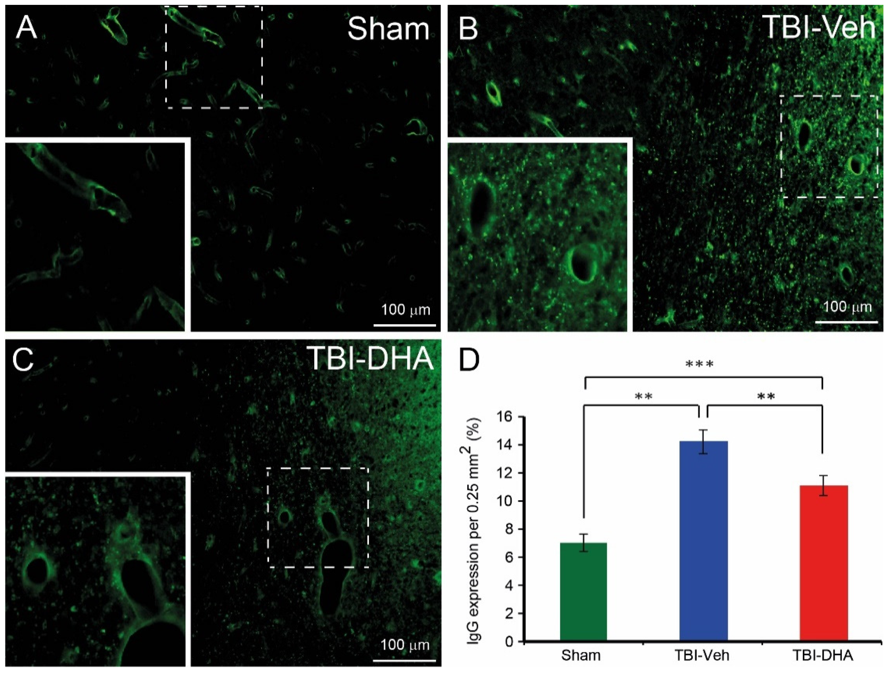 Ijms Free Full Text Dha Attenuates Cerebral Edema Following Traumatic Brain Injury Via The Reduction In Blood Brain Barrier Permeability Html