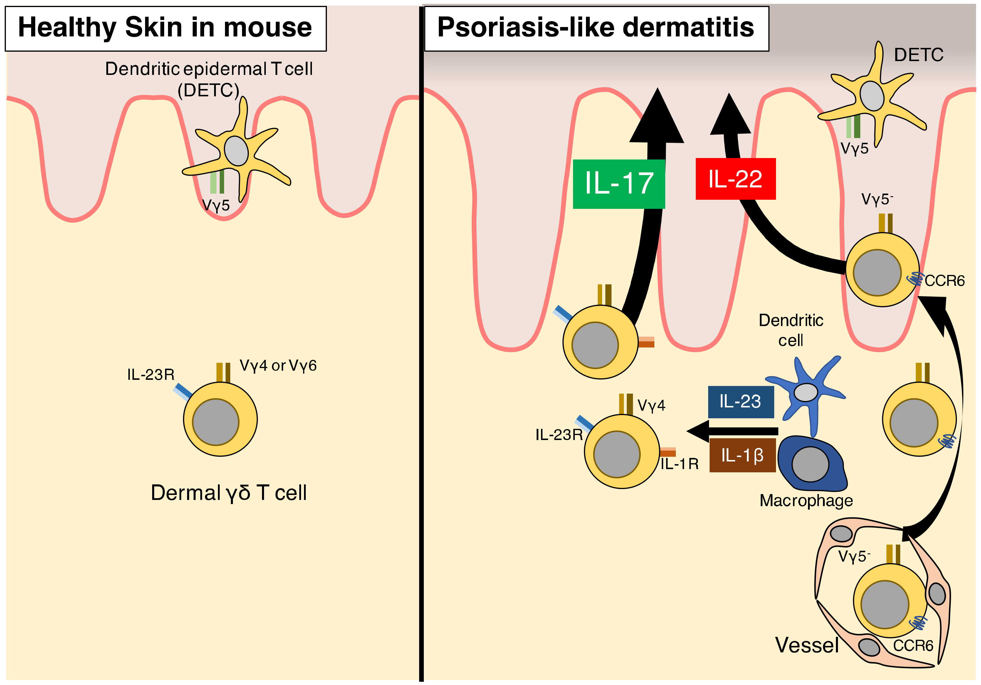 Ijms Free Full Text Role Of Innate Immune Cells In Psoriasis Html