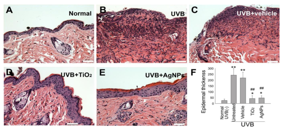 IJMS | Free Full-Text | Silver Nanoparticles Protect Skin From ...