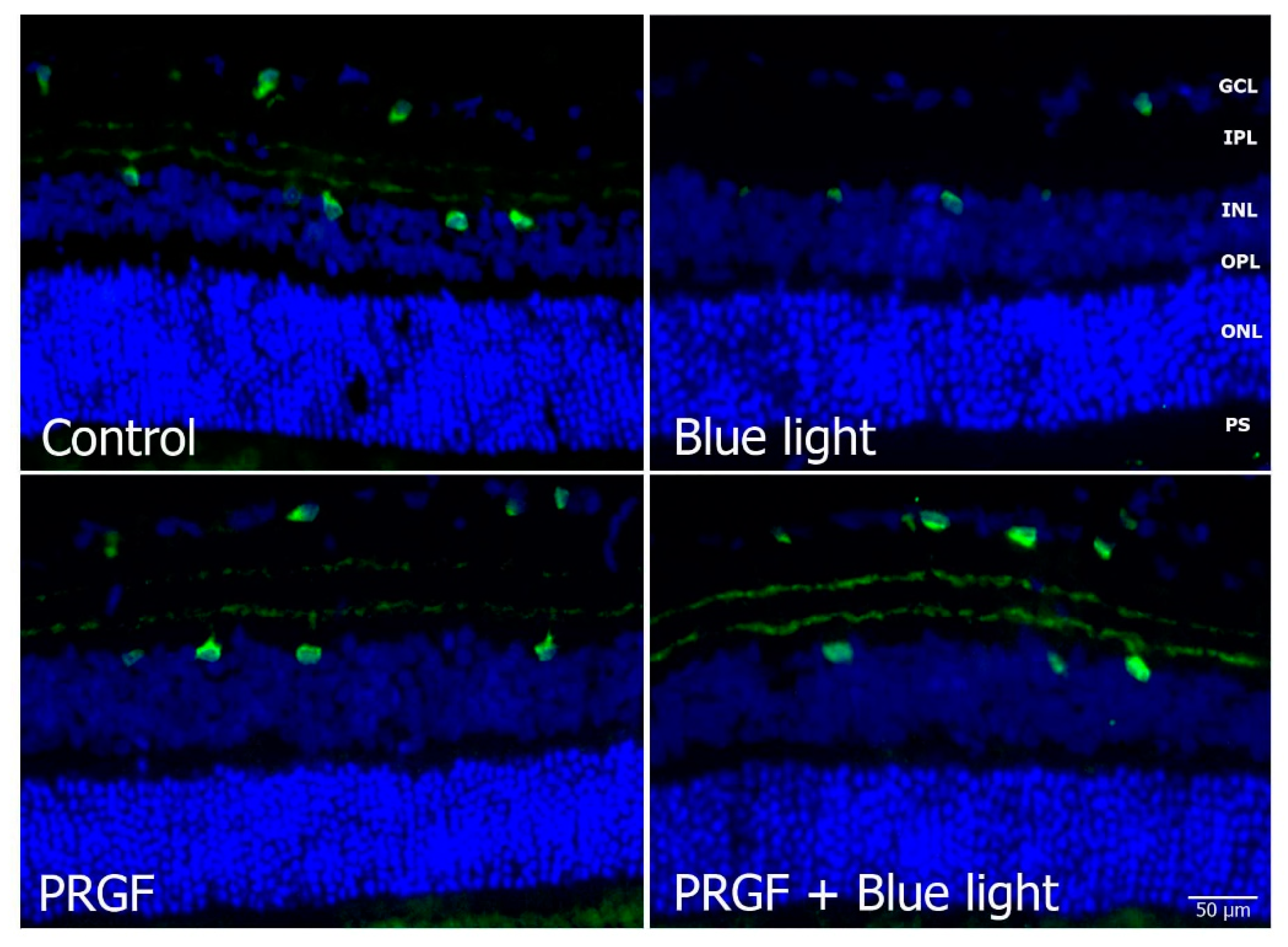 Ijms 21 07442 g005 Ijms 21 07442 g005