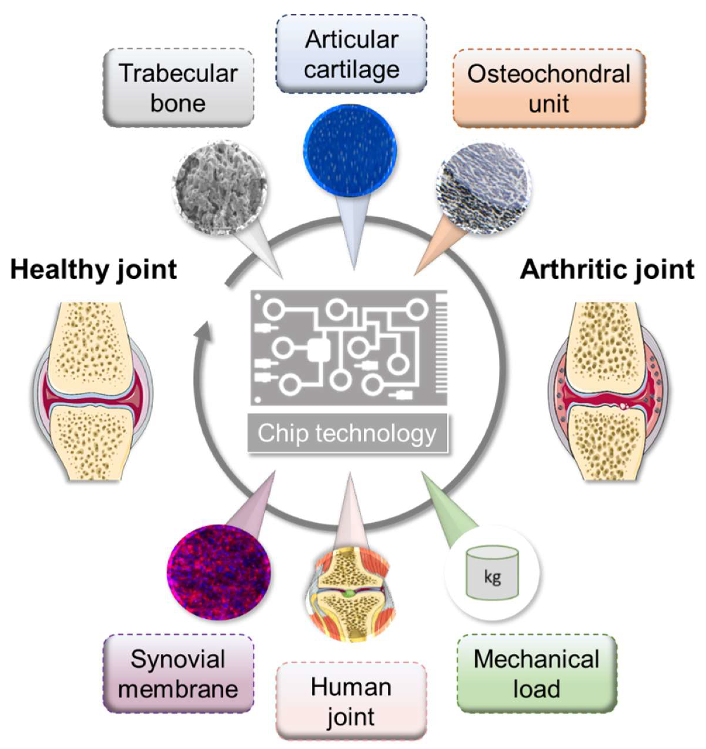 rheumatoid arthritis experimental study