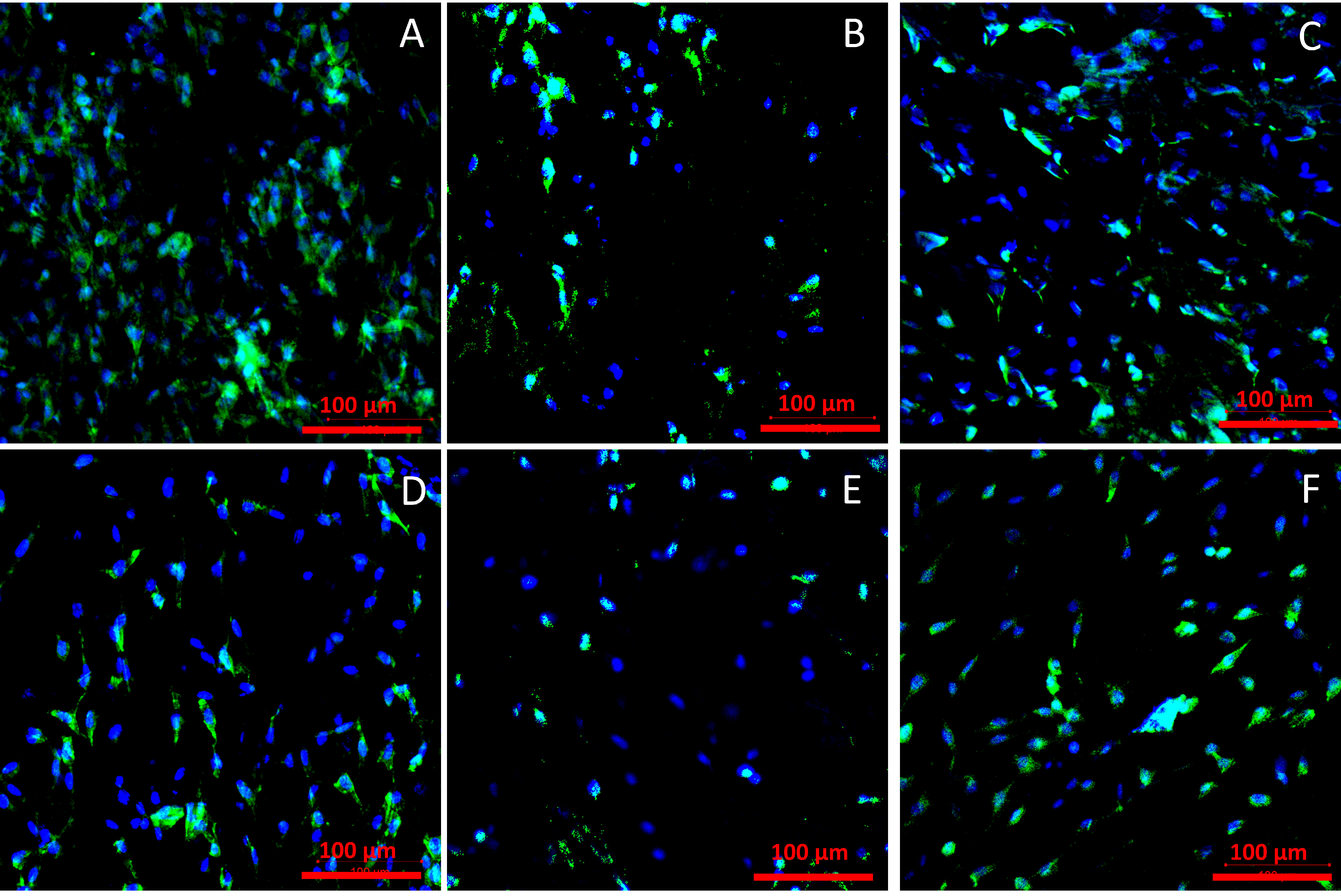 Ijms Free Full Text Evaluation Of Sterilization Disinfection Methods Of Fibrous Polyurethane Scaffolds Designed For Tissue Engineering Applications Html