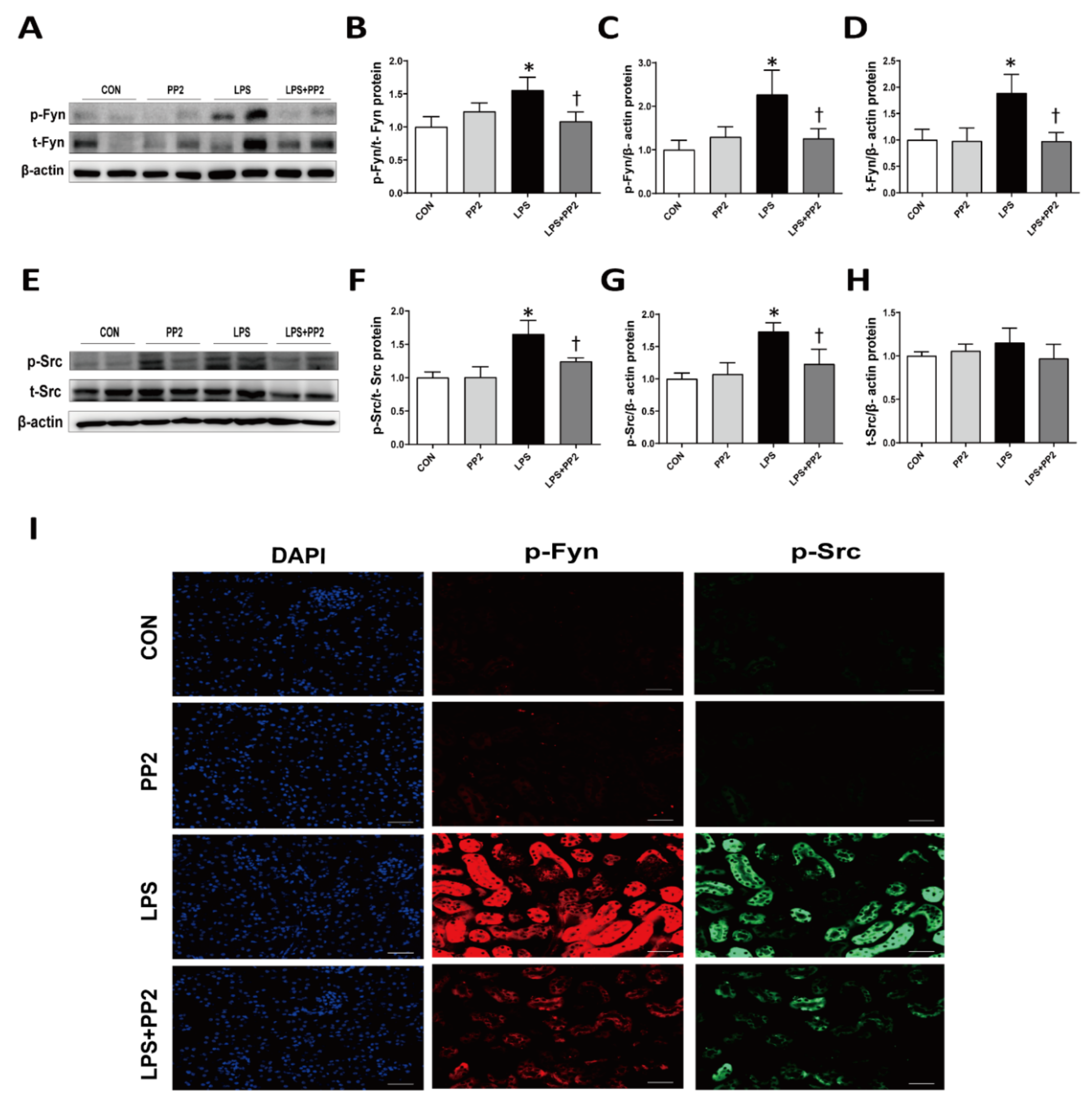 Ijms Free Full Text Inhibition Of Src Family Kinases Ameliorates Lps Induced Acute Kidney Injury And Mitochondrial Dysfunction In Mice Html