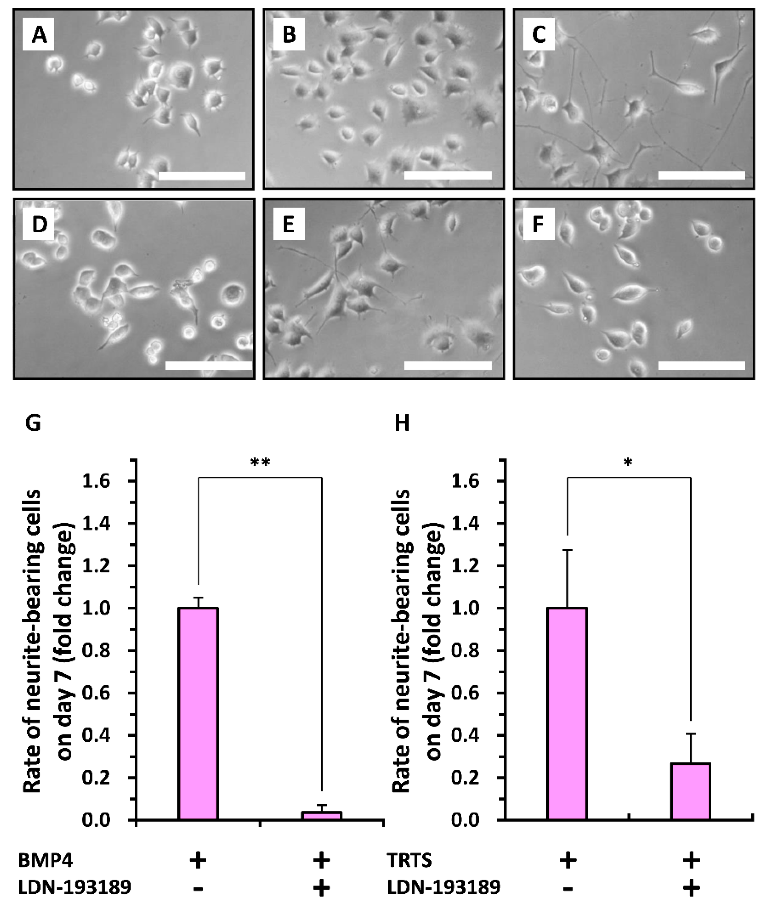 Ijms 21 08356 g008 Ijms 21 08356 g008