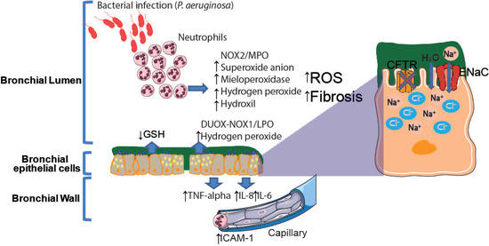 IJMS | Free Full-Text | Airway Redox Homeostasis and Inflammation Gone  Awry: From Molecular Pathogenesis to Emerging Therapeutics in Respiratory  Pathology