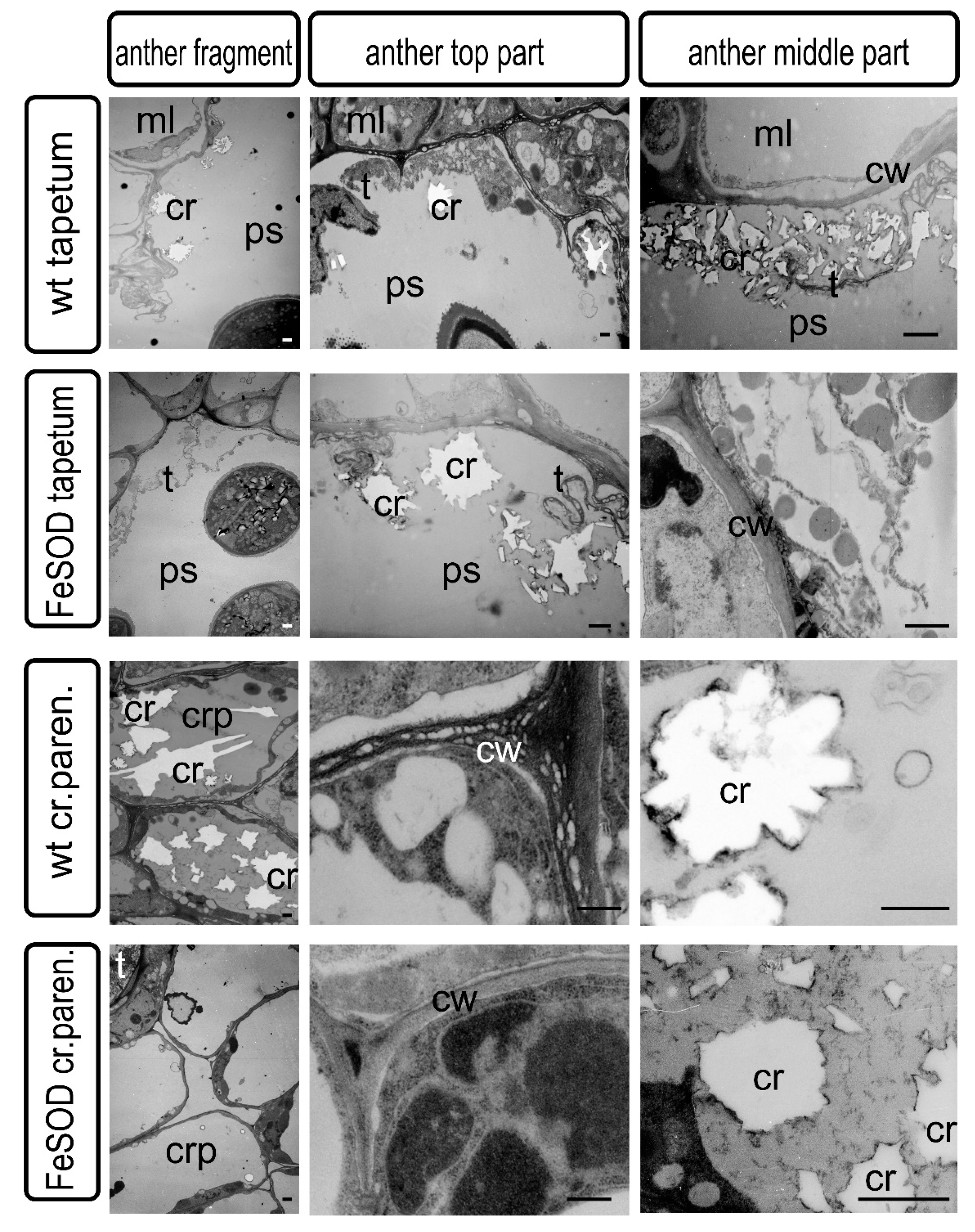 IJMS | Free Full-Text | Possible Role of Crystal-Bearing Cells in