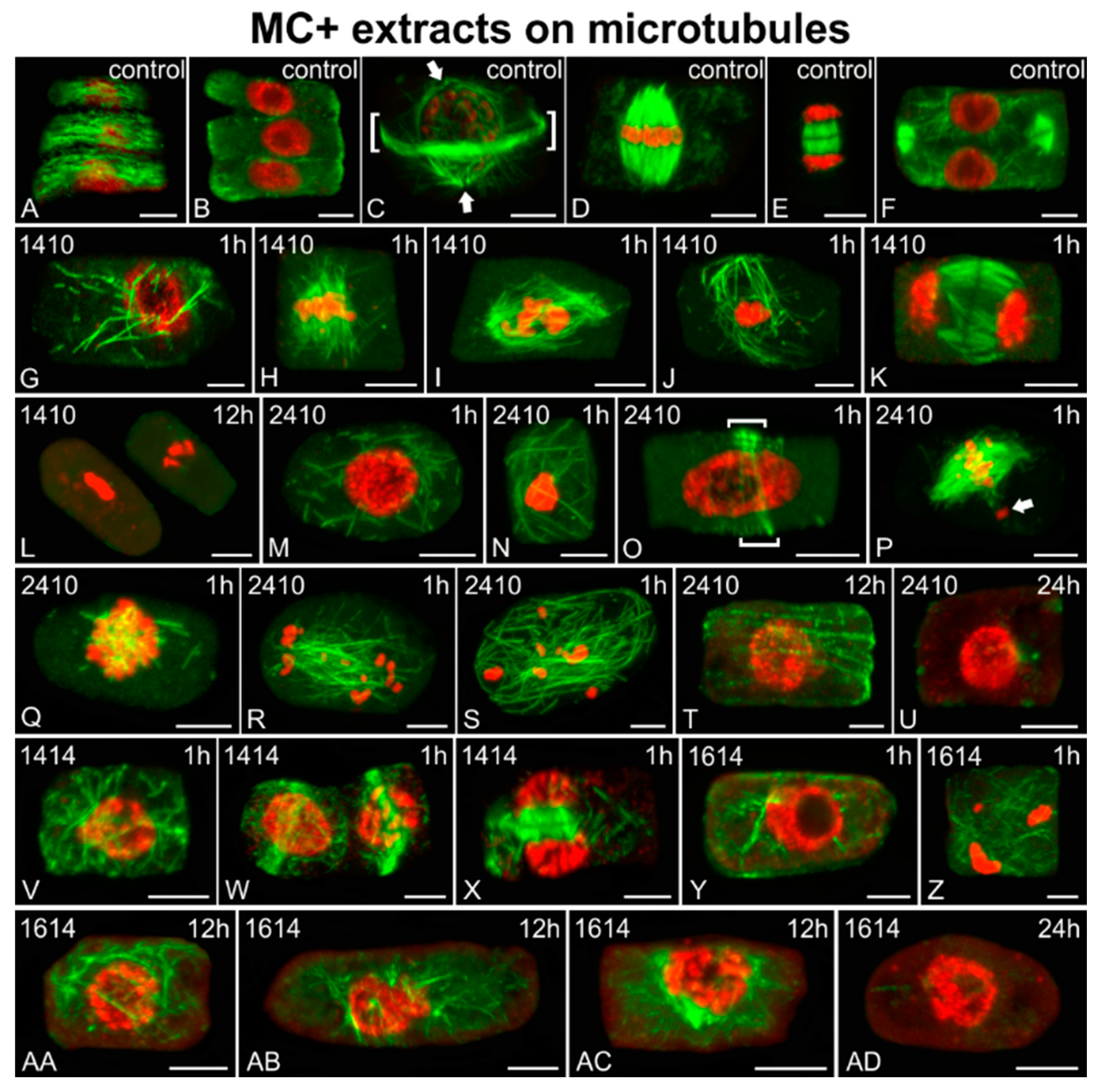 Ijms Free Full Text Beyond Microcystins Cyanobacterial Extracts Induce Cytoskeletal Alterations In Rice Root Cells Html