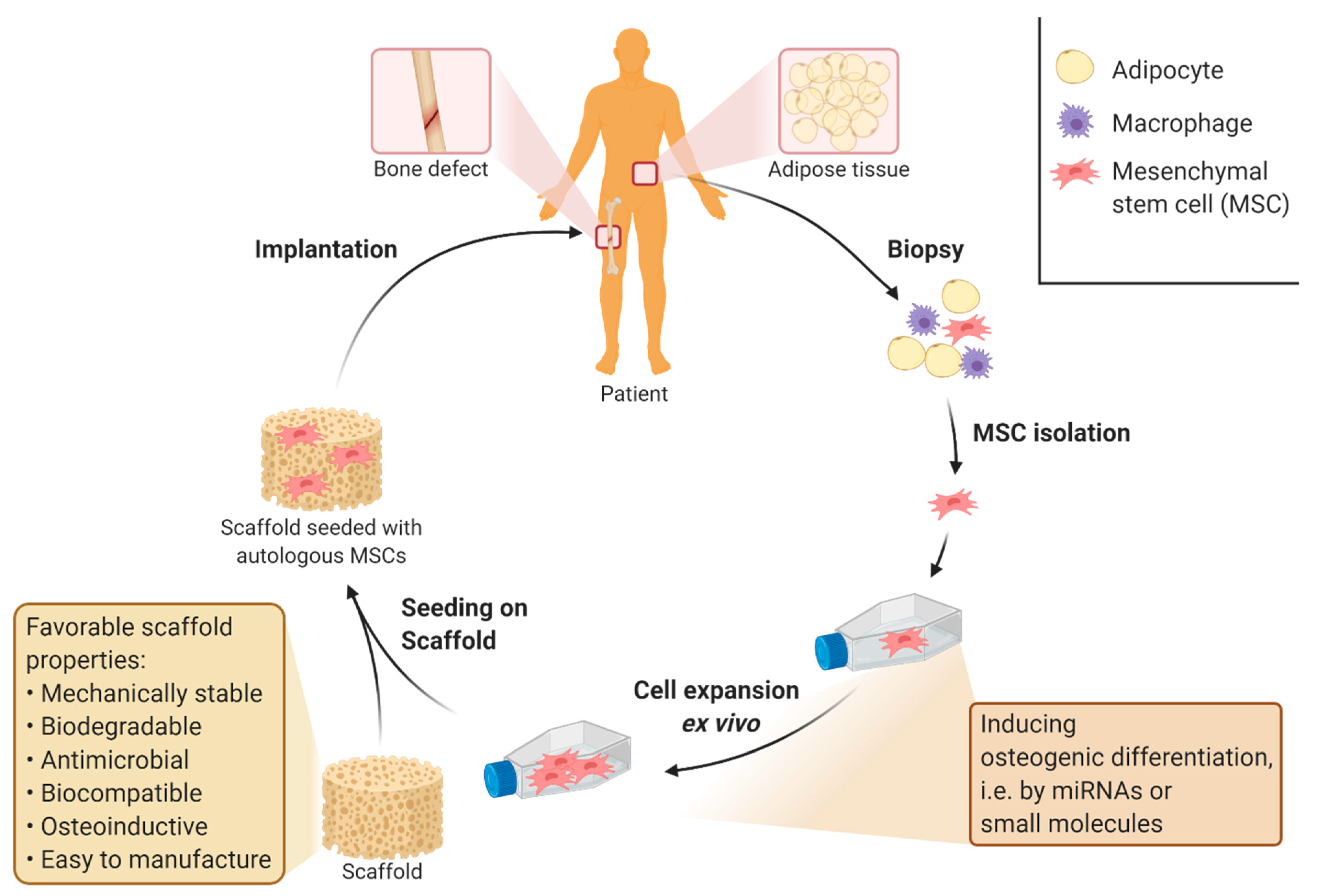 Stem cell-based bone regeneration in diseased microenvironments: Challenges  and solutions - ScienceDirect