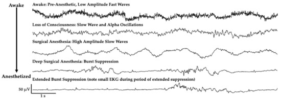 IJMS | Free Full-Text | Molecular Diversity of Anesthetic Actions Is ...