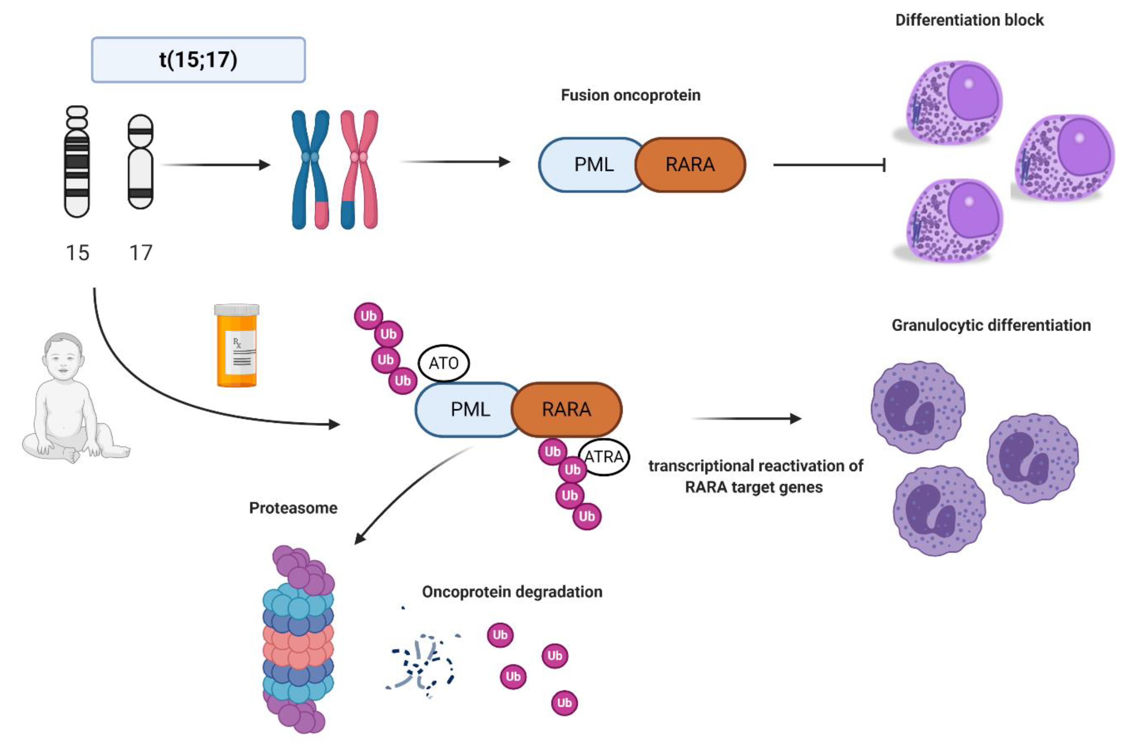 IJMS | Free Full-Text | Acute Promyelocytic Leukemia in Children: A Model  of Precision Medicine and Chemotherapy-Free Therapy | HTML