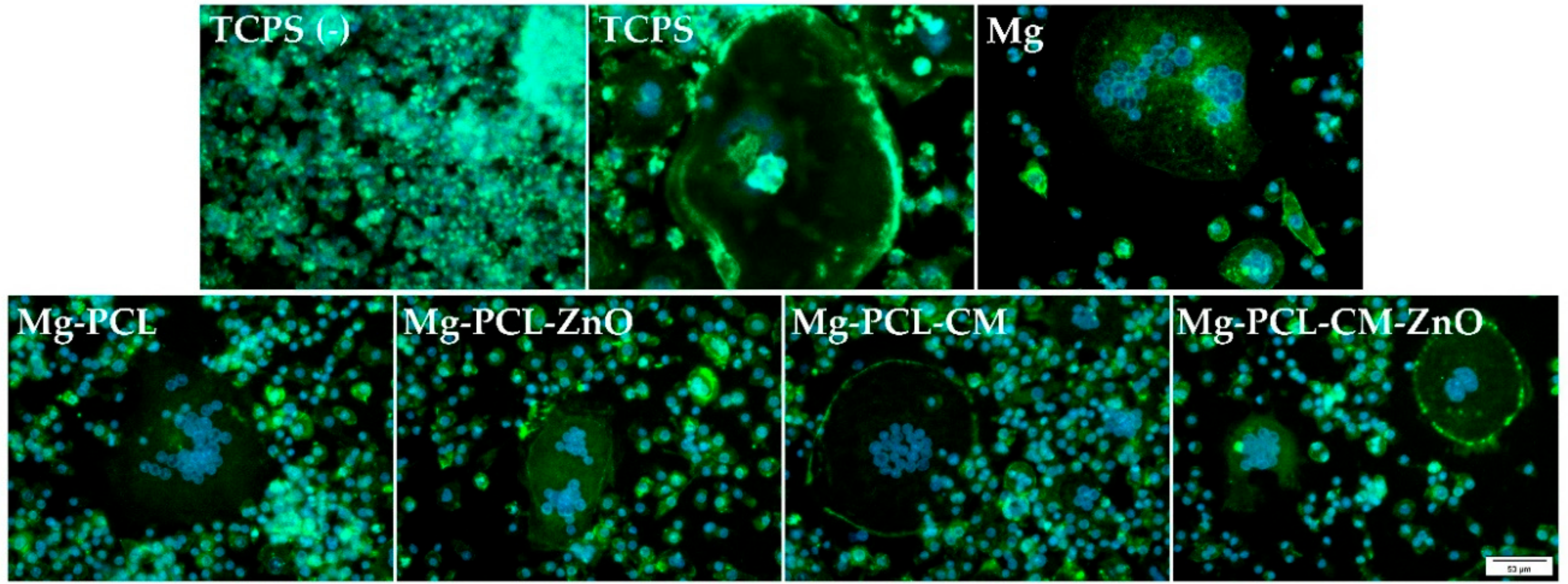 IJMS | Free Full-Text | In Vitro Macrophage Immunomodulation by  Poly(ε-caprolactone) Based-Coated AZ31 Mg Alloy