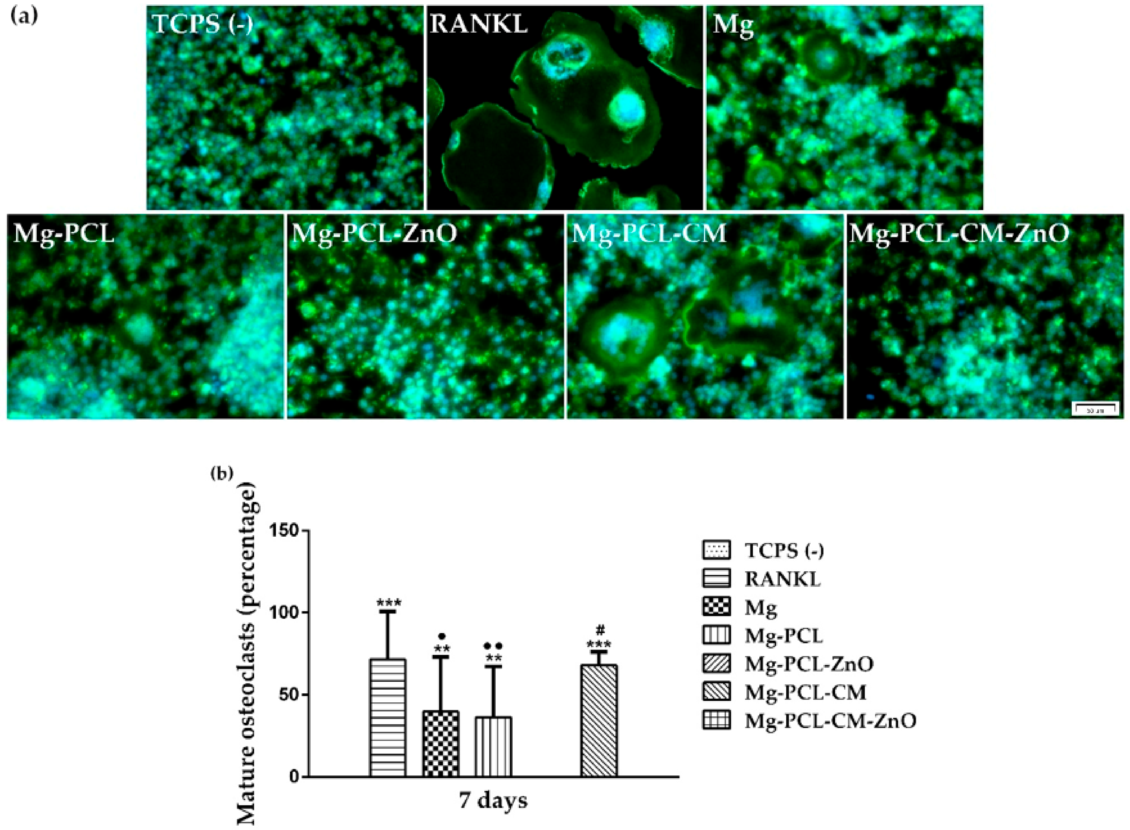 IJMS | Free Full-Text | In Vitro Macrophage Immunomodulation by  Poly(ε-caprolactone) Based-Coated AZ31 Mg Alloy