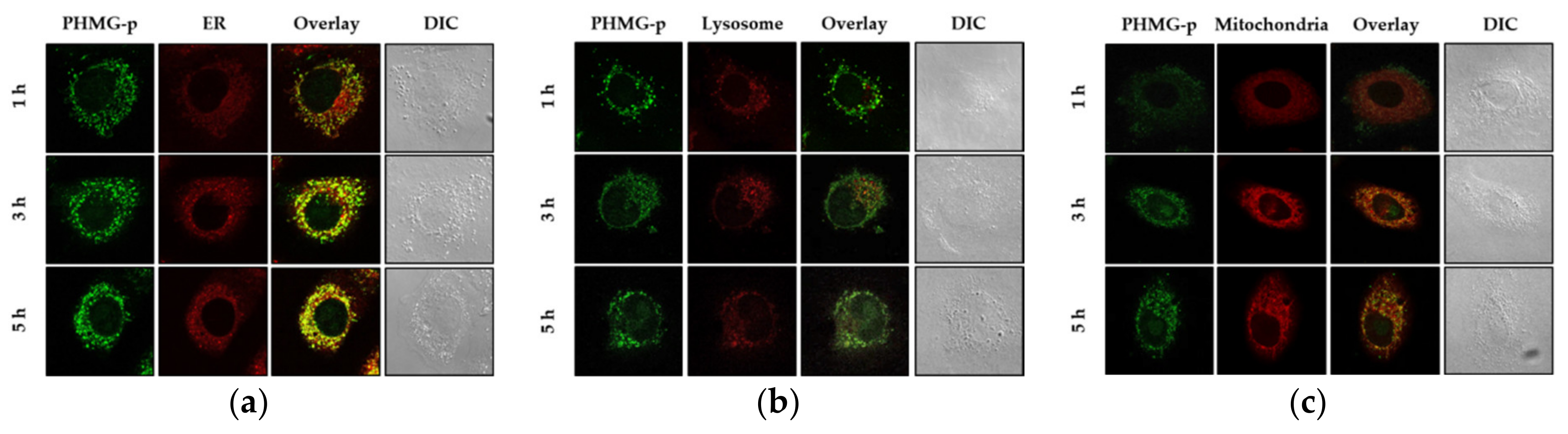 Ijms Free Full Text Polyhexamethylene Guanidine Phosphate Induces Apoptosis Through Endoplasmic Reticulum Stress In Lung Epithelial Cells Html