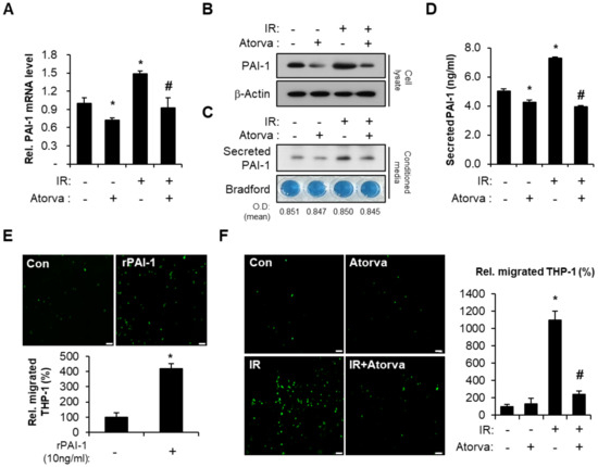 Suppressive Role of Endogenous Endothelial Monocyte Chemoattractant  Protein–1 on Monocyte Transendothelial Migration In Vitro