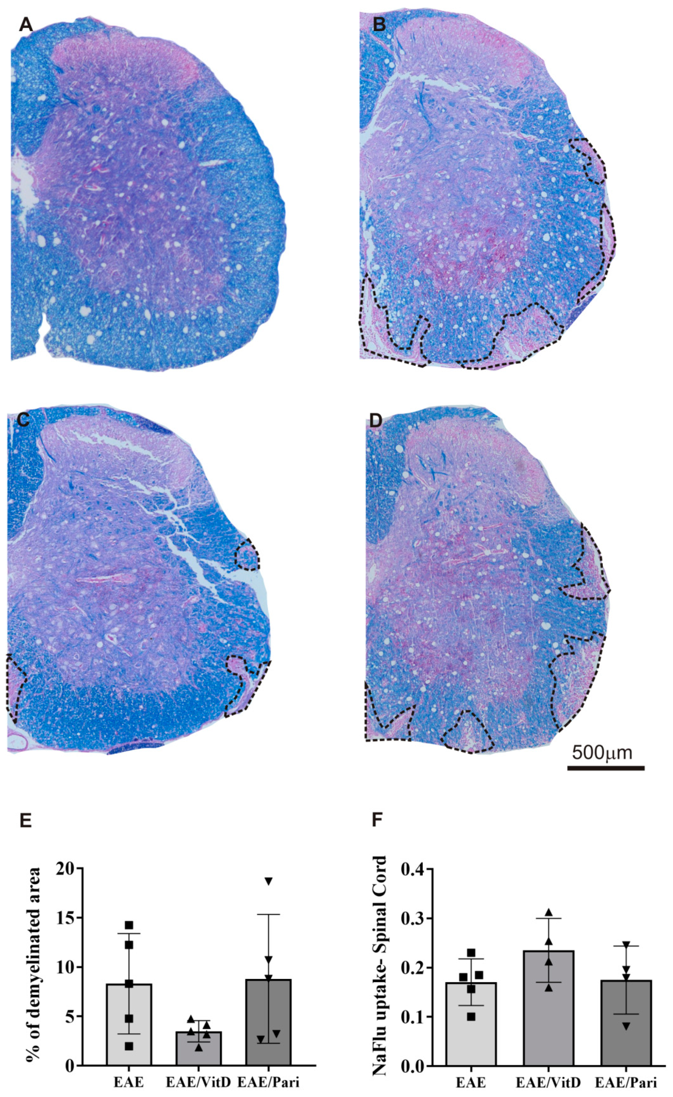 IJMS | Free Full-Text | Preclinical Therapy with Vitamin D3 in