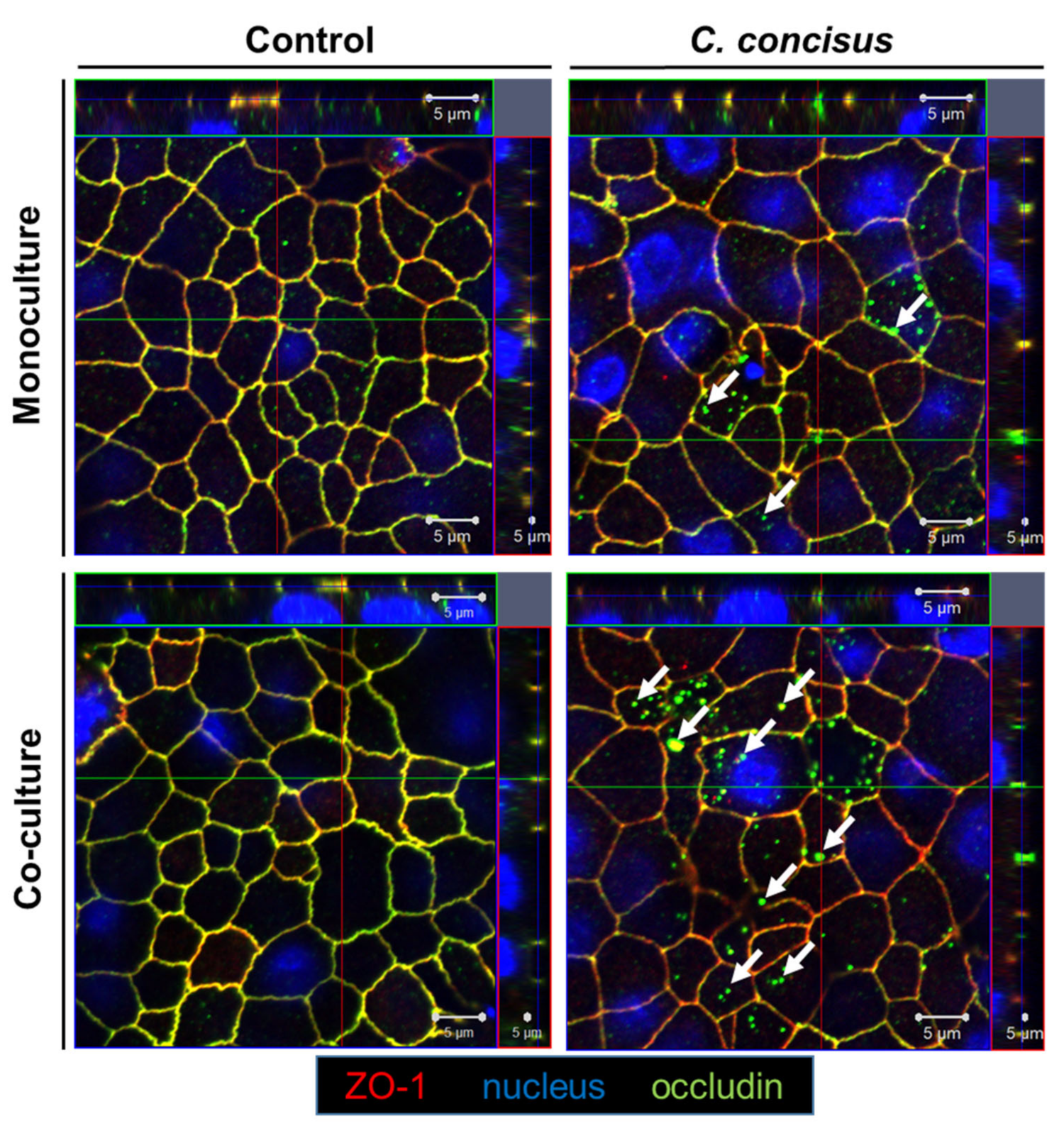 Ijms Free Full Text Immune Mediated Aggravation Of The Campylobacter Concisus Induced Epithelial Barrier Dysfunction Html