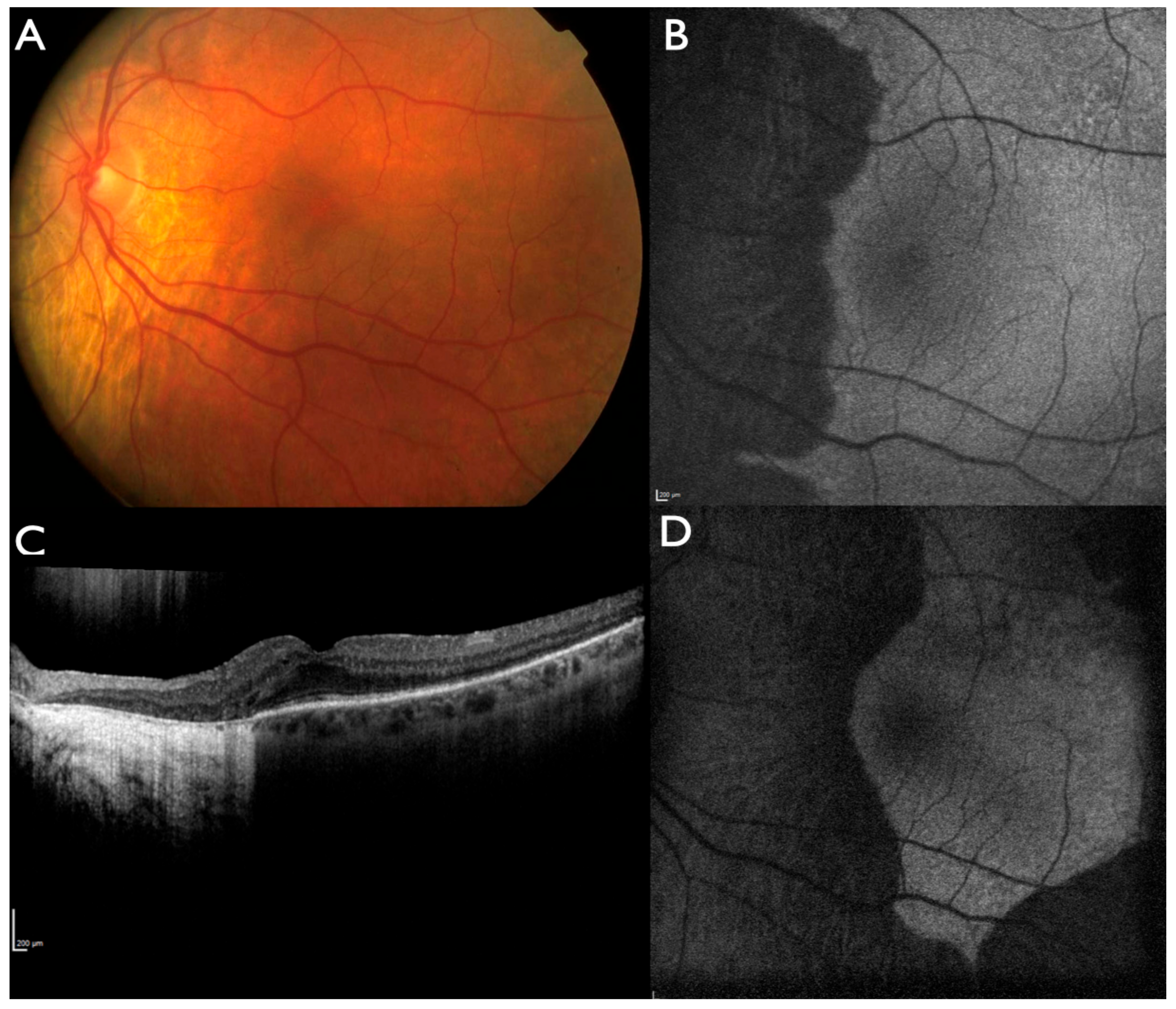 Ijms 22 02089 g004 Ijms 22 02089 g004