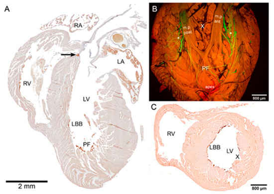 IJMS | Free Full-Text | Gap Junctional Communication via Connexin43 between  Purkinje Fibers and Working Myocytes Explains the Epicardial Activation  Pattern in the Postnatal Mouse Left Ventricle