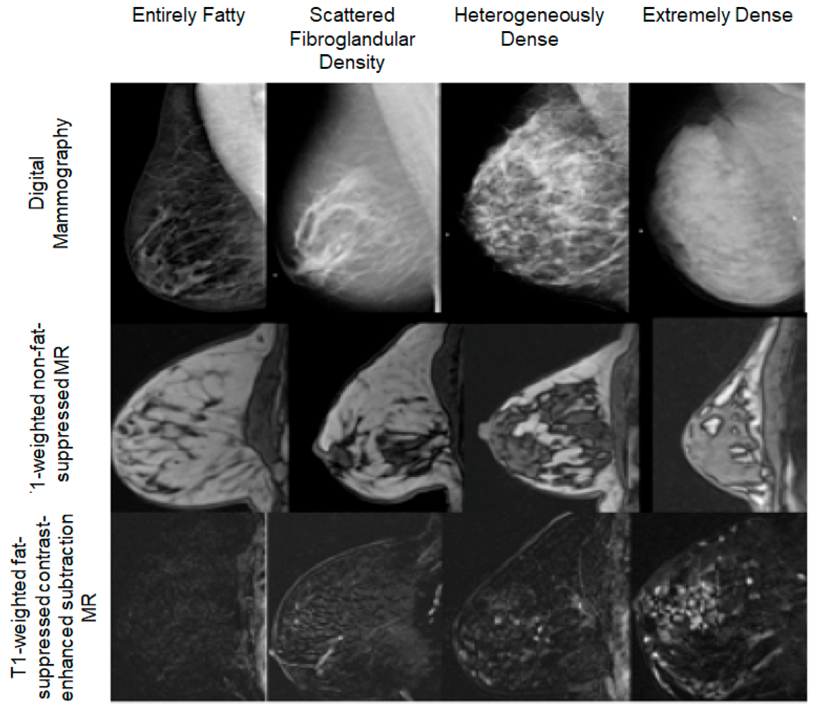 Breast CT developers aim to 'revolutionize' mammography