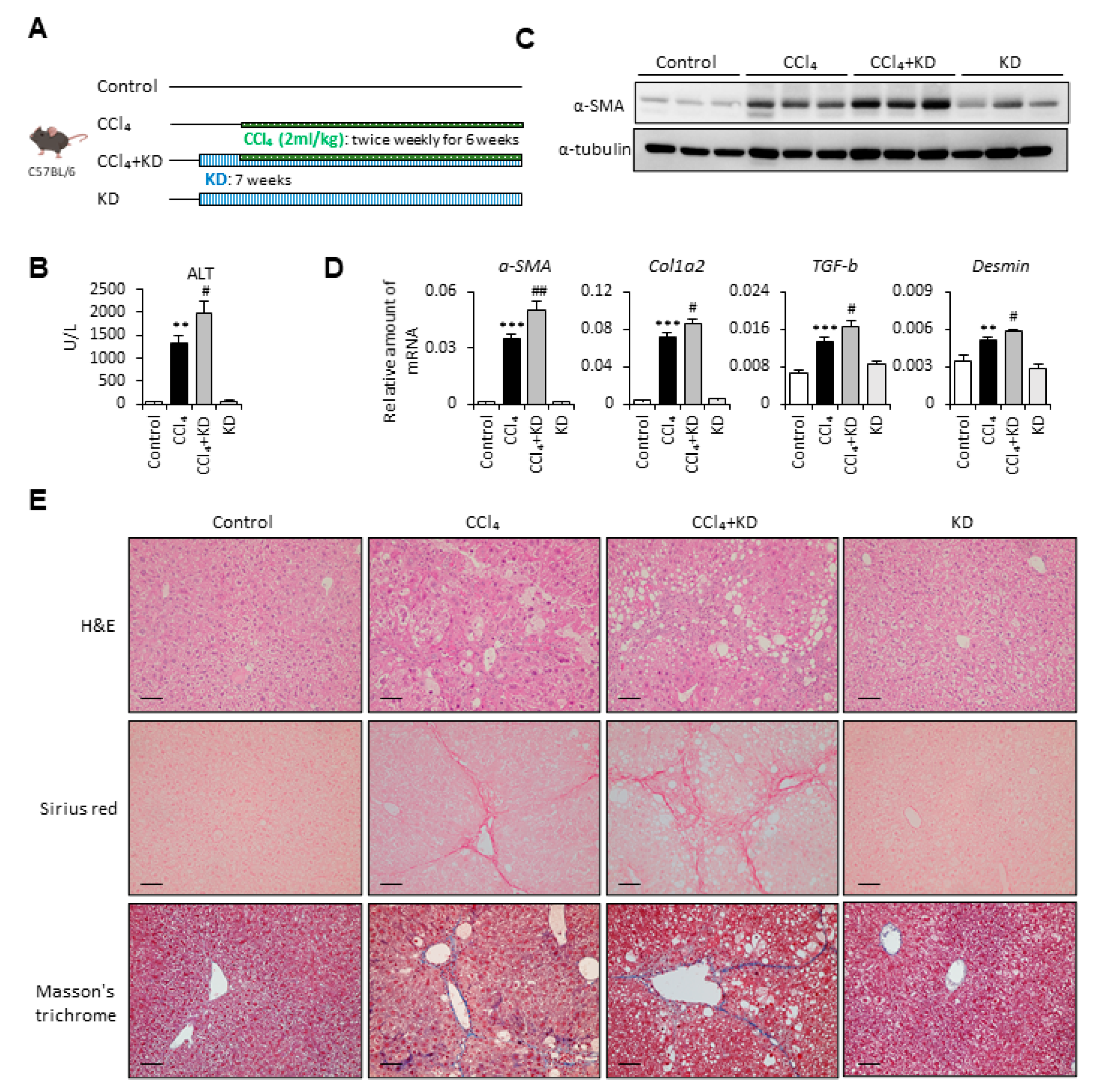 IJMS | Free Full-Text | Ketogenic Diet Enhances the Cholesterol