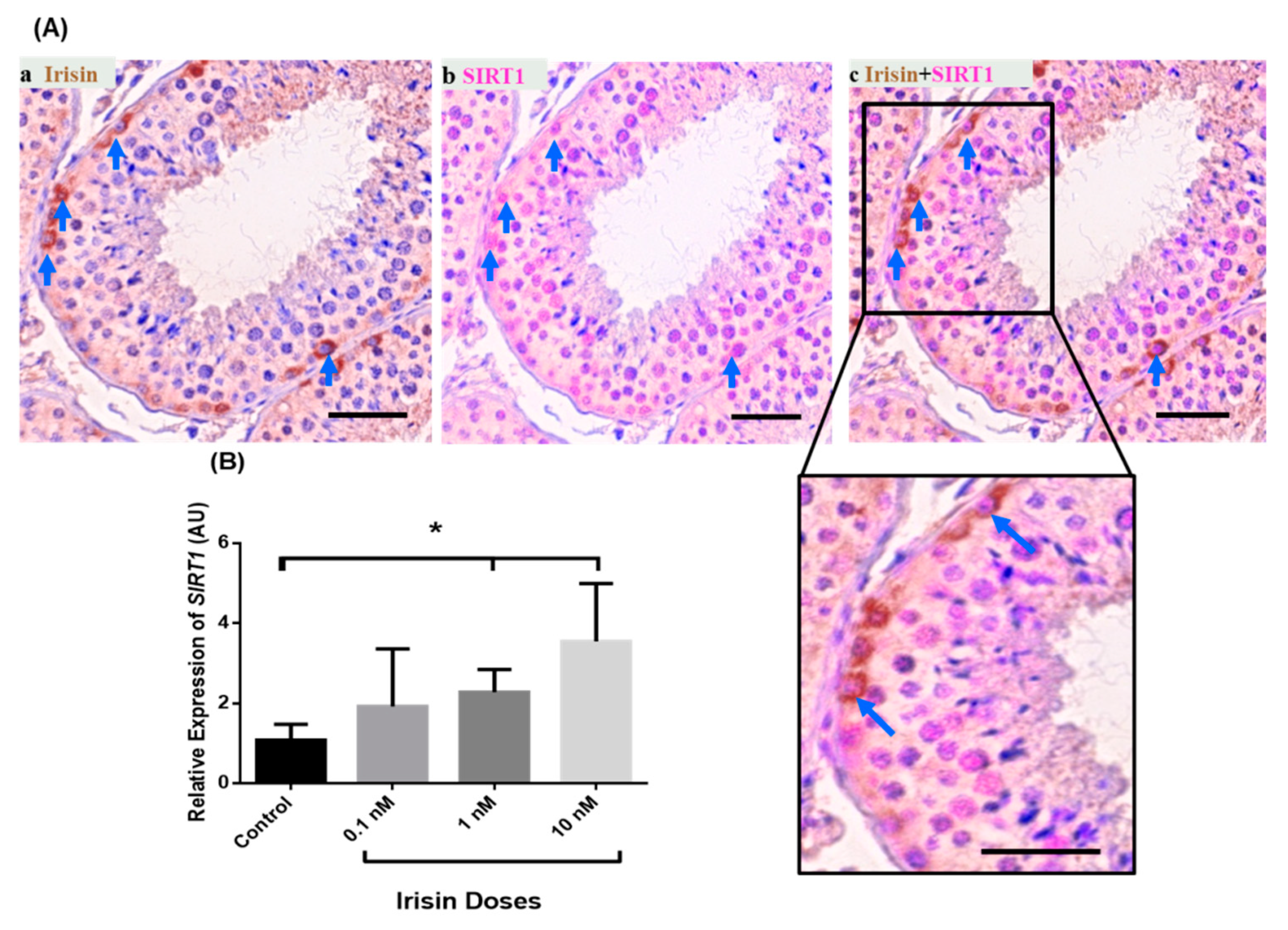 Ijms 22 03207 g005 Ijms 22 03207 g005