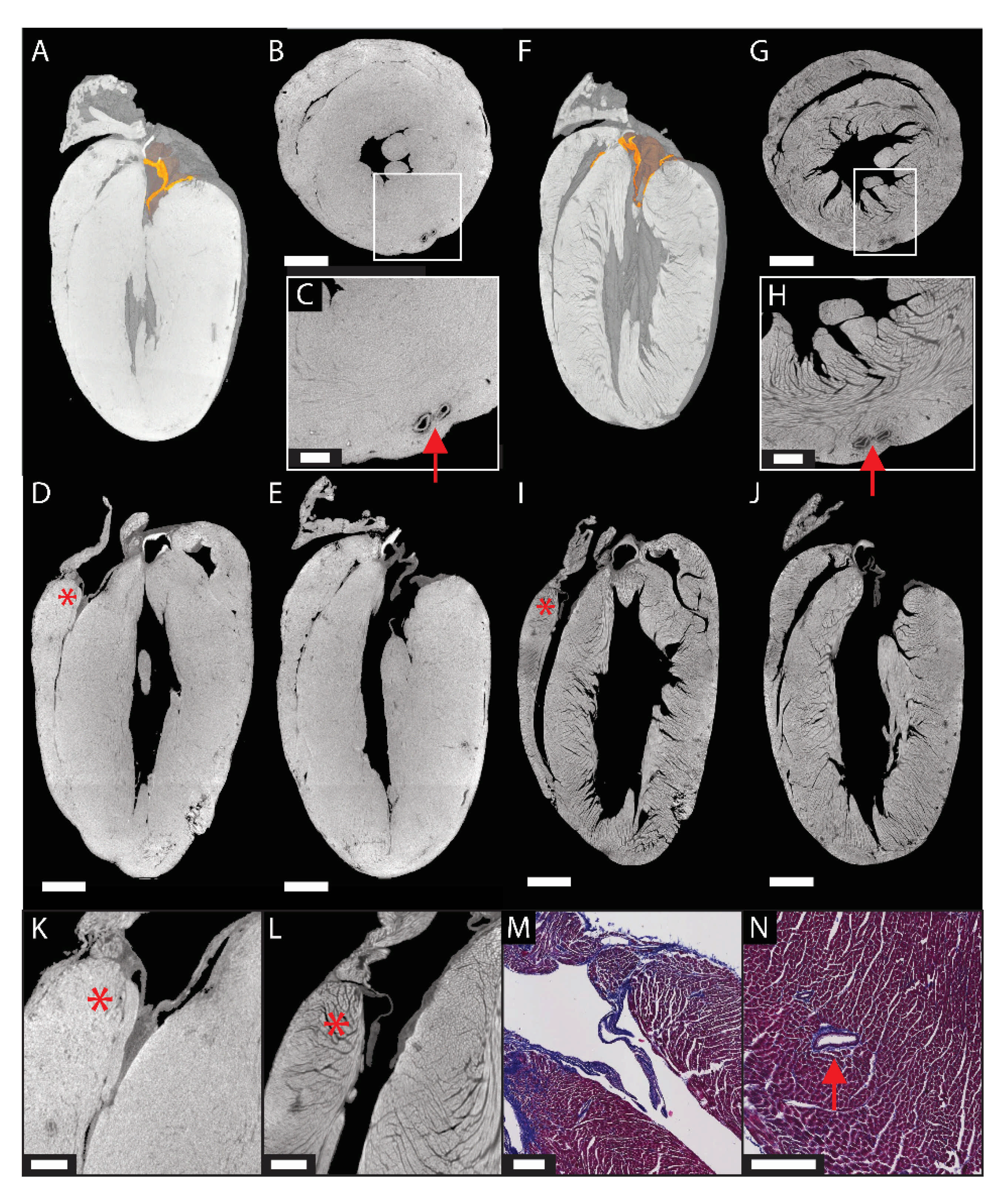 Ijms Free Full Text A Review Of Ex Vivo X Ray Microfocus Computed Tomography Based Characterization Of The Cardiovascular System Html