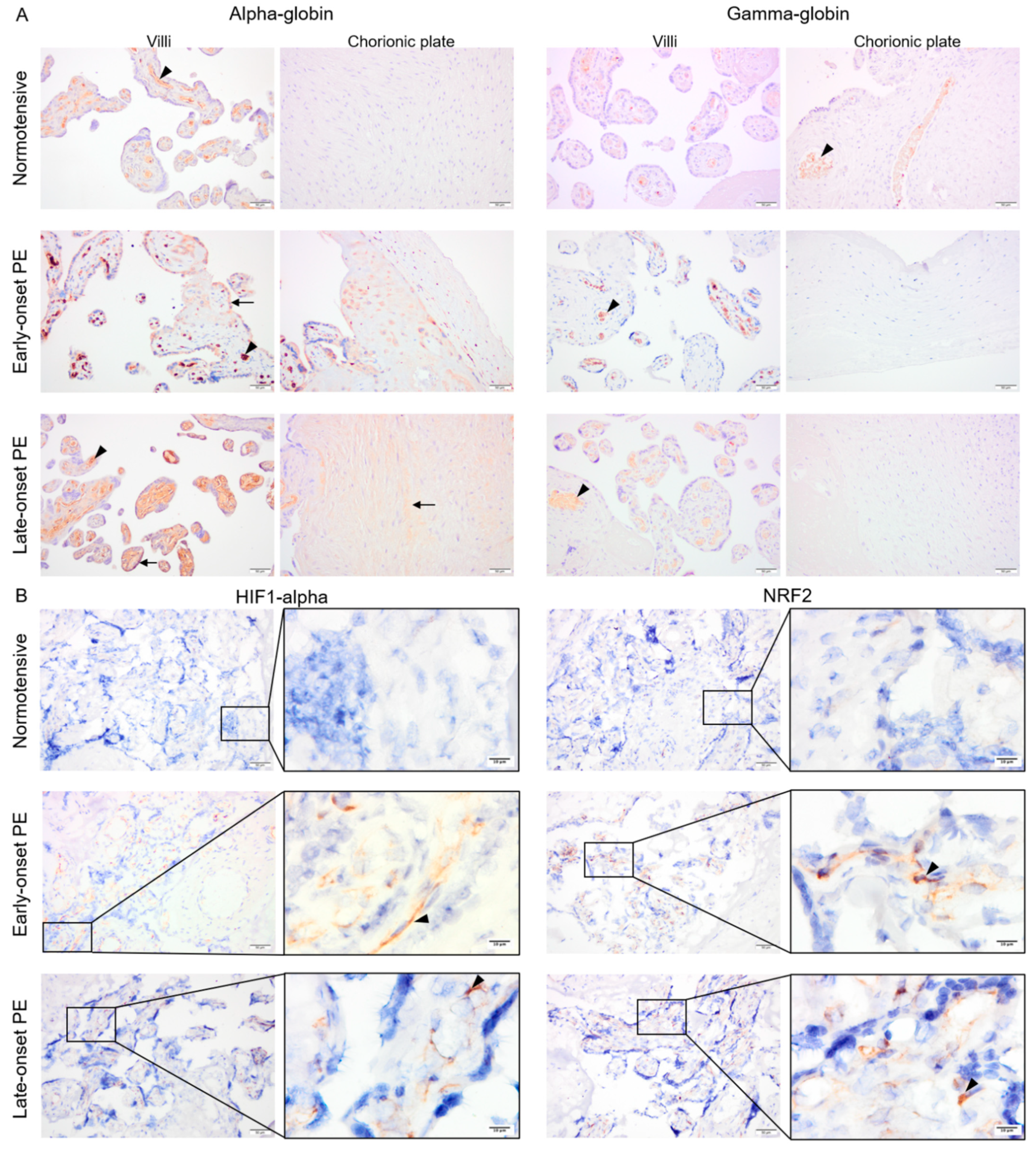 Ijms 22 03357 g003 Ijms 22 03357 g003