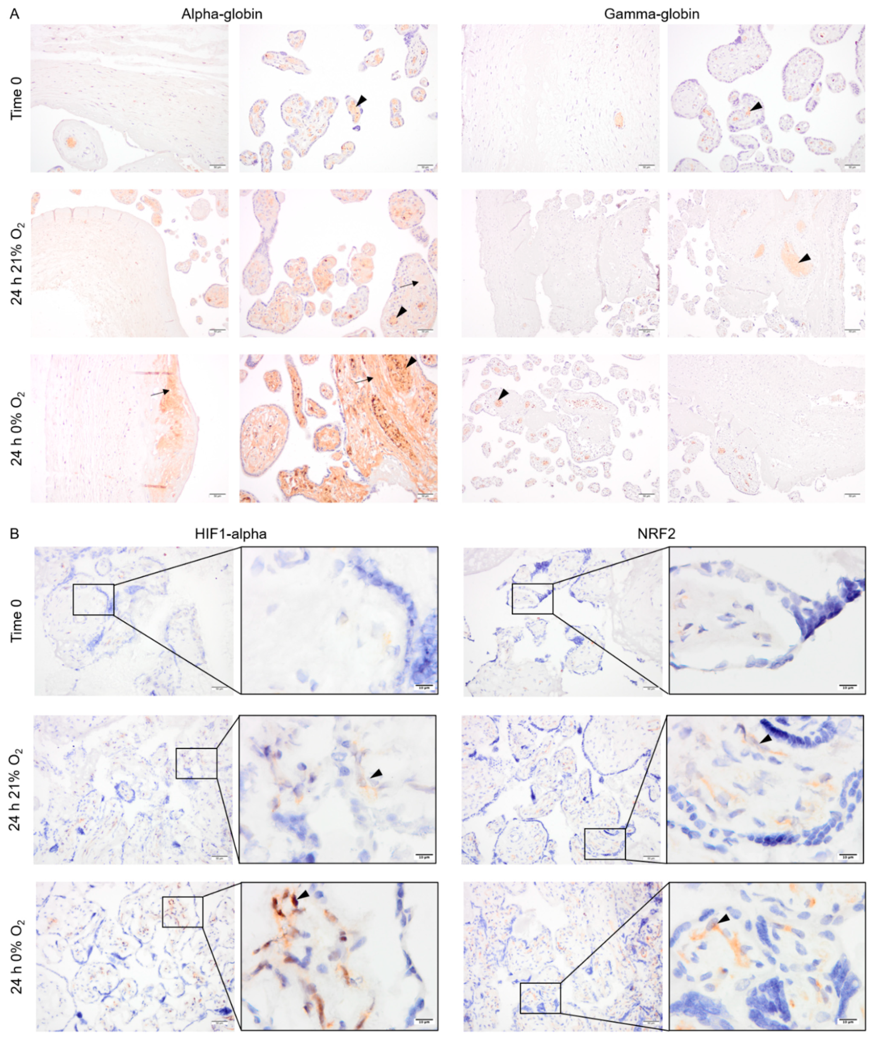 Ijms 22 03357 g004 Ijms 22 03357 g004