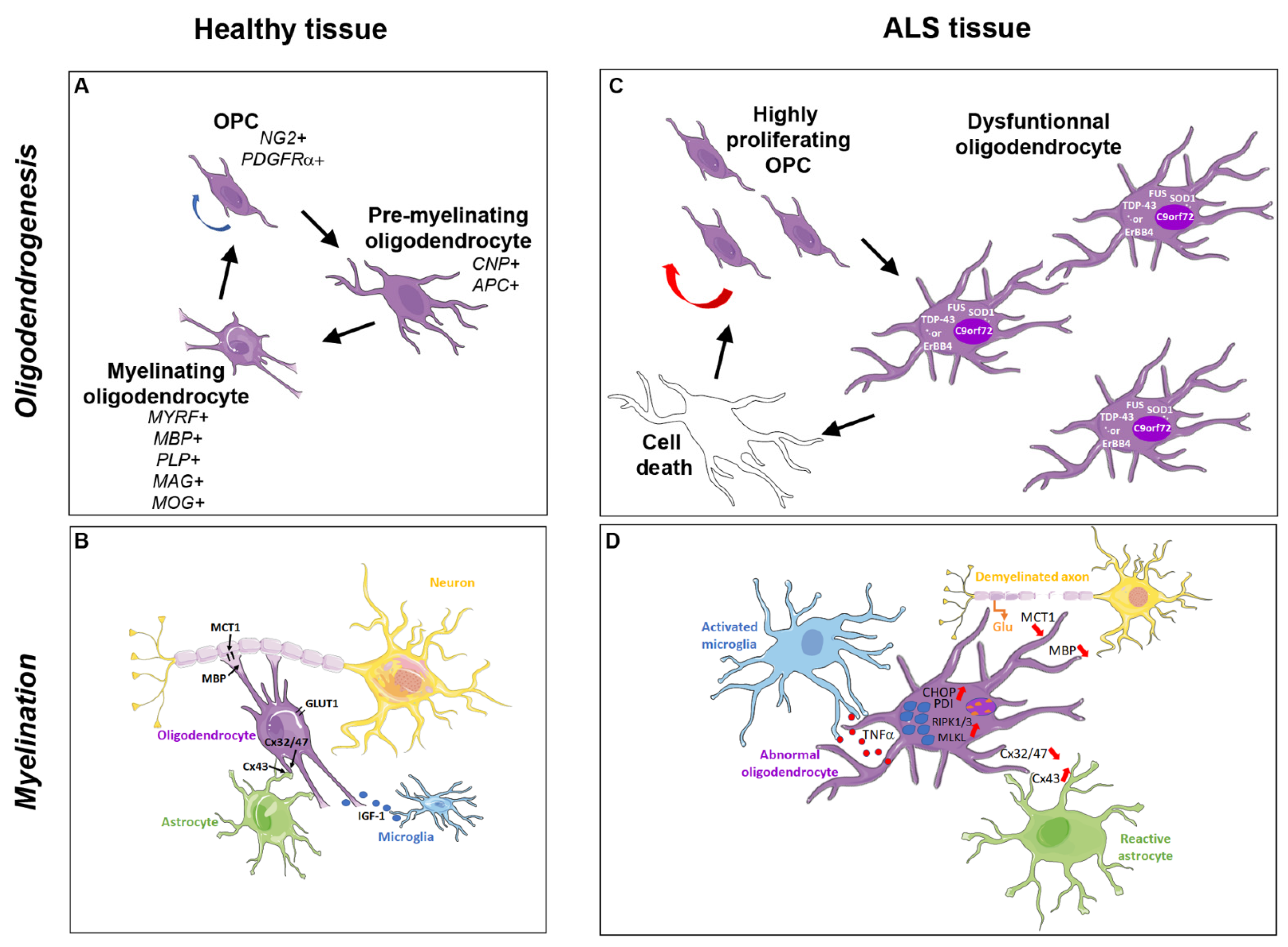 IJMS | Free Full-Text | Defective Oligodendroglial Lineage and  Demyelination in Amyotrophic Lateral Sclerosis