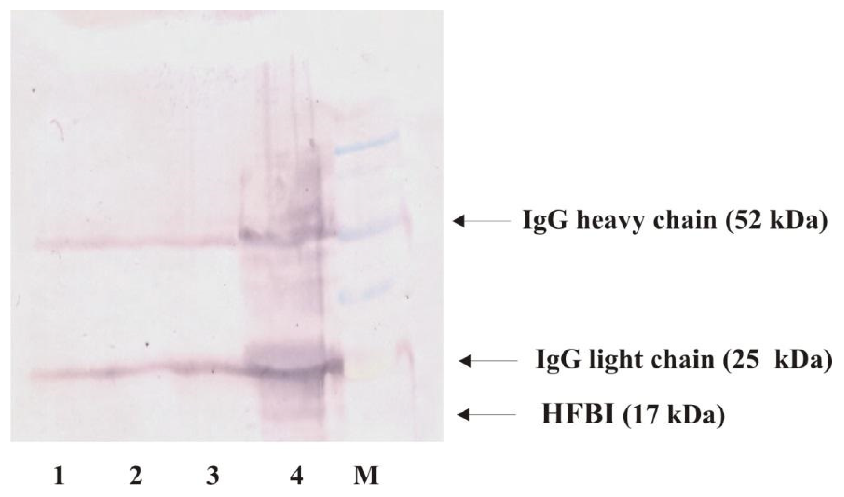 Ijms 22 03491 g005 Ijms 22 03491 g005