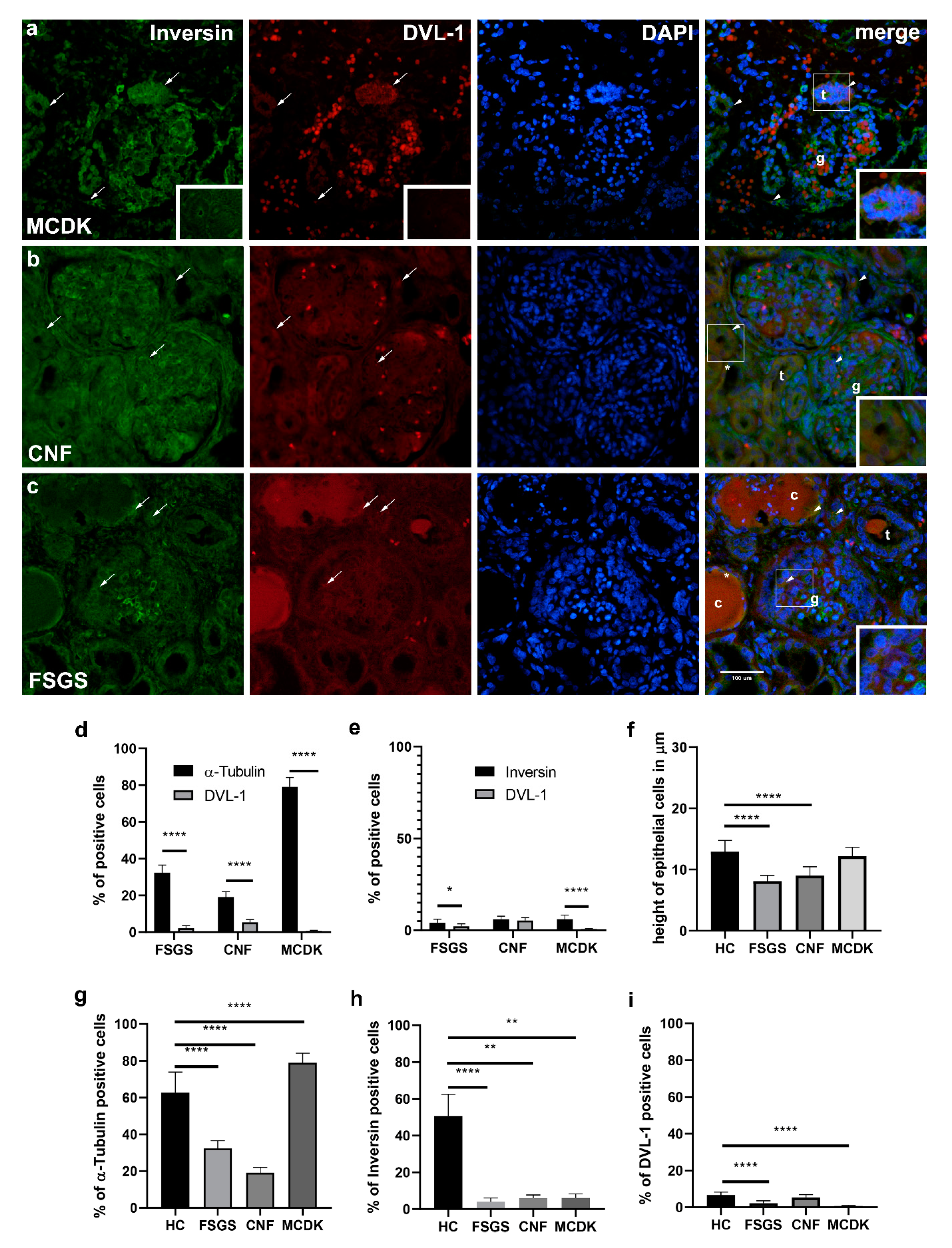 Ijms Free Full Text Expression Pattern Of A Tubulin Inversin And Its Target Dishevelled 1 And Morphology Of Primary Cilia In Normal Human Kidney Development And Diseases Html