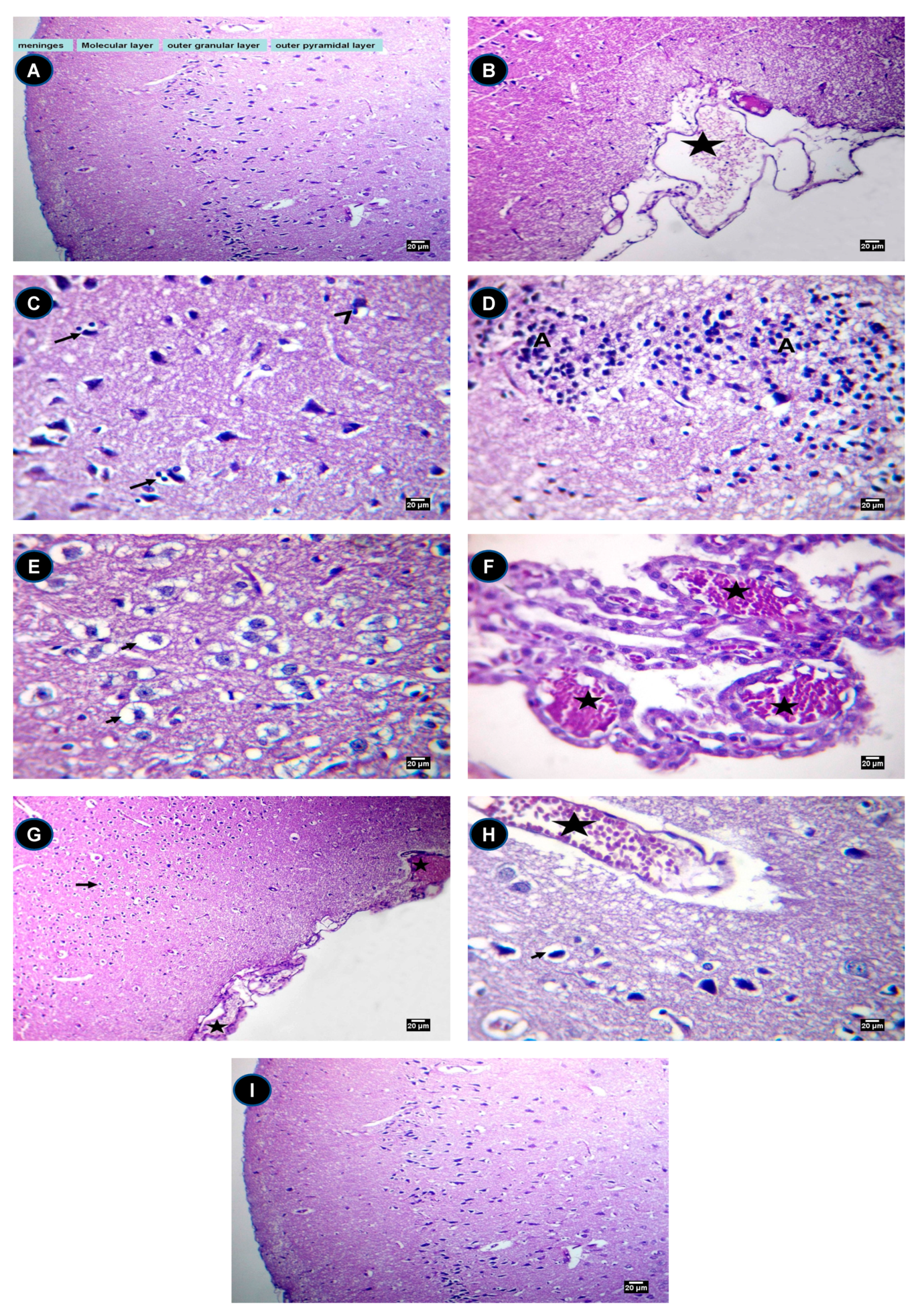 Ijms 22 03829 sch001 Ijms 22 03829 sch001