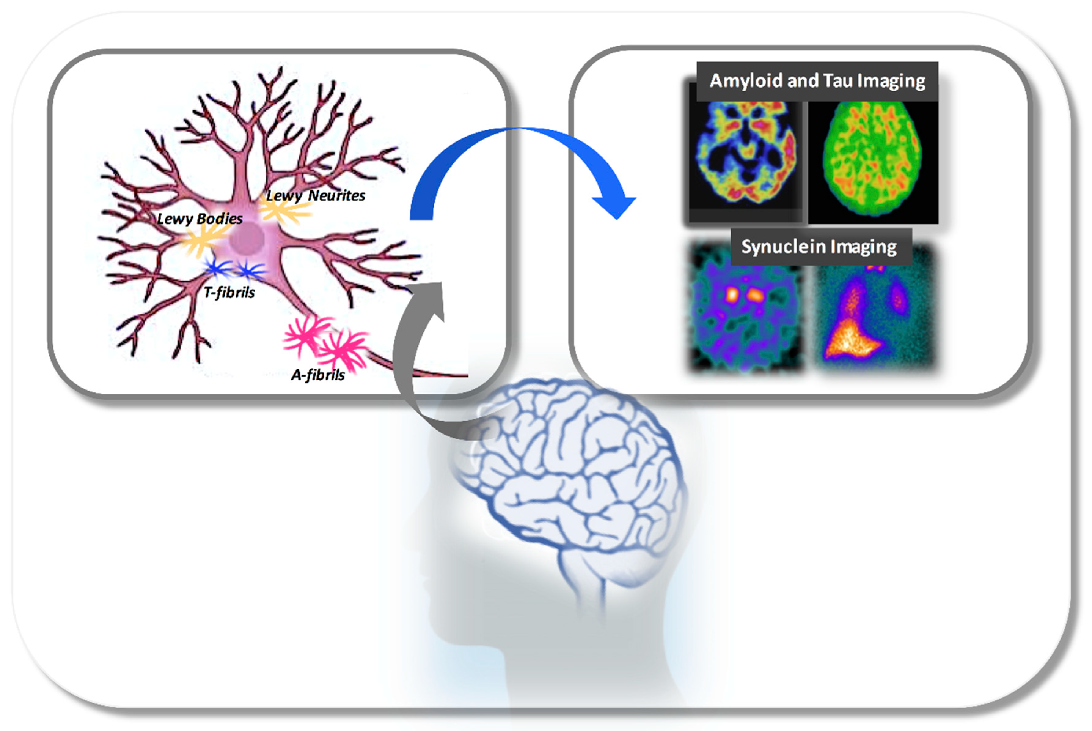 IJMS | Free Full-Text | Genetic Architecture and Molecular, Imaging and  Prodromic Markers in Dementia with Lewy Bodies: State of the Art,  Opportunities and Challenges