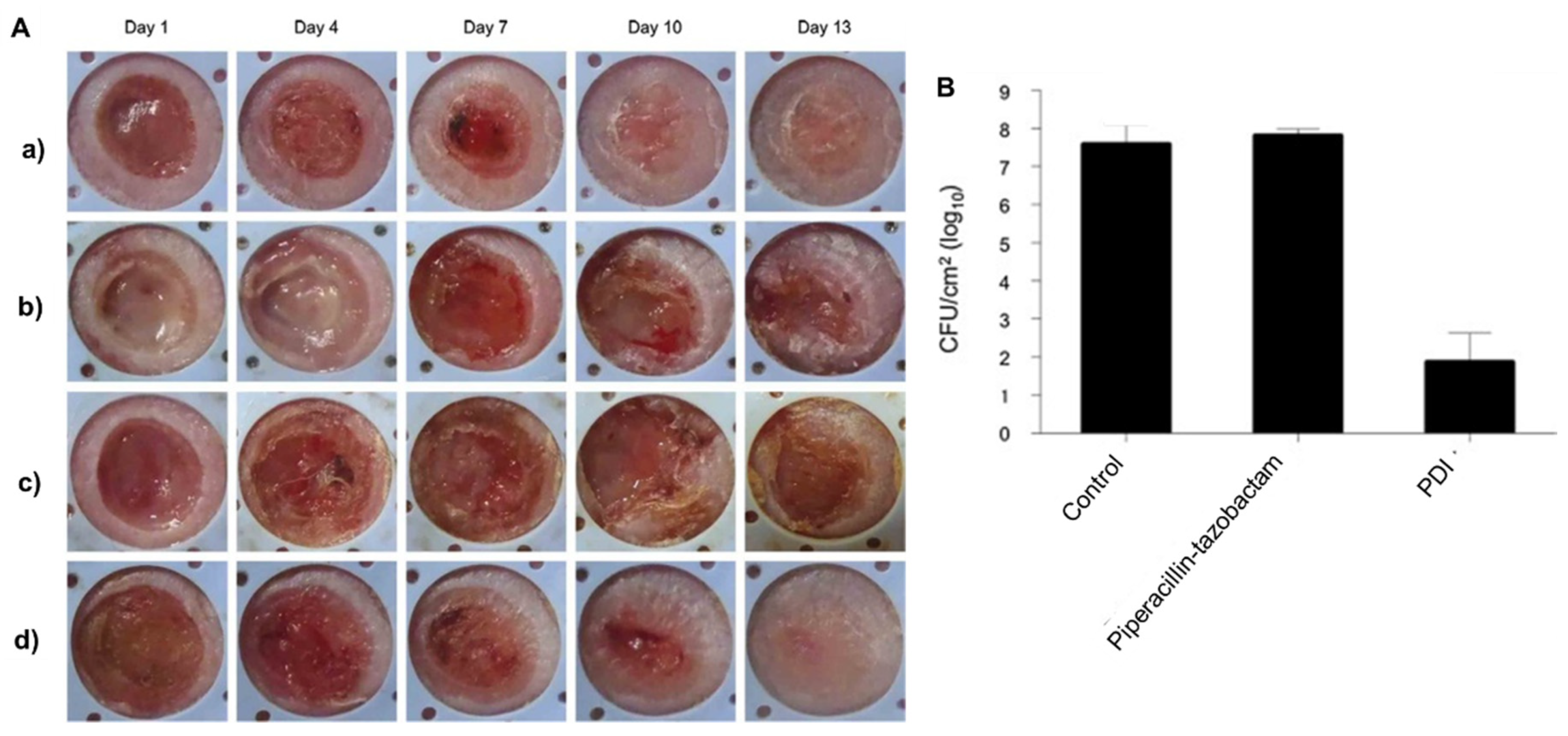 Ijms Free Full Text The Role Of Porphyrinoid Photosensitizers For Skin Wound Healing Html