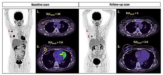 SubtlePET 2.0 Gets CE Mark • APPLIED RADIOLOGY