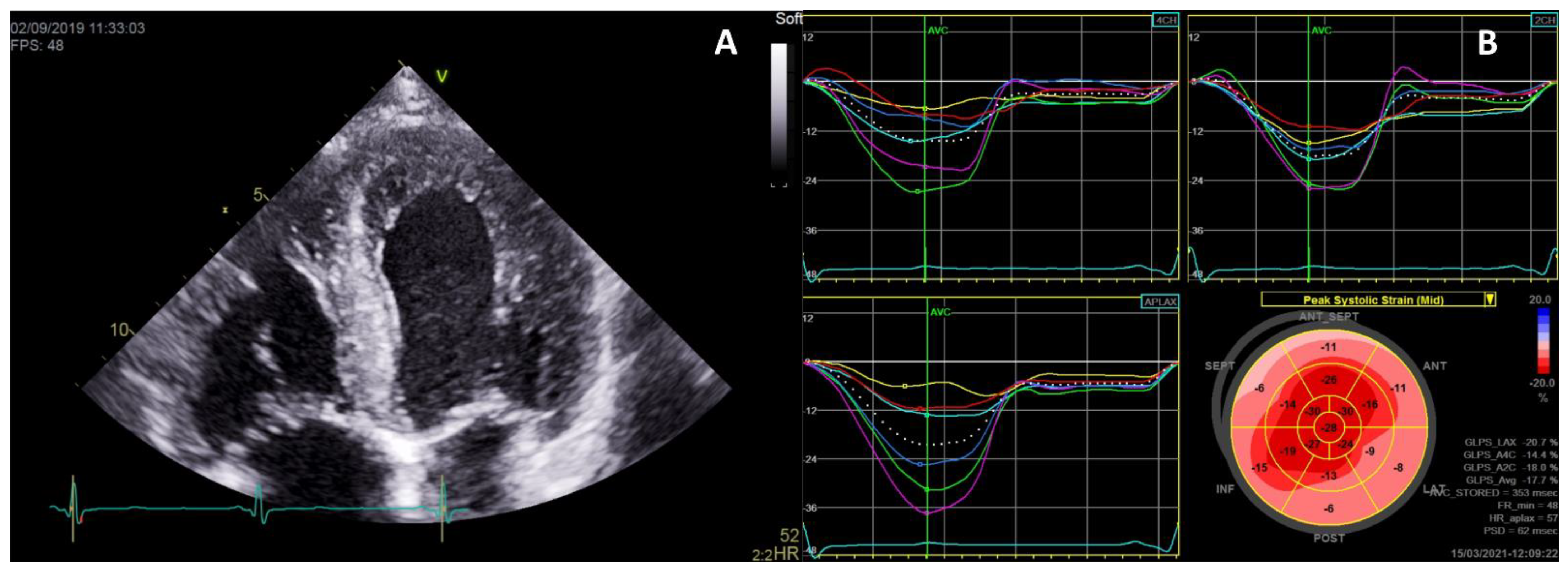 Ijms Free Full Text Fabry Disease And The Heart A Comprehensive Review Html