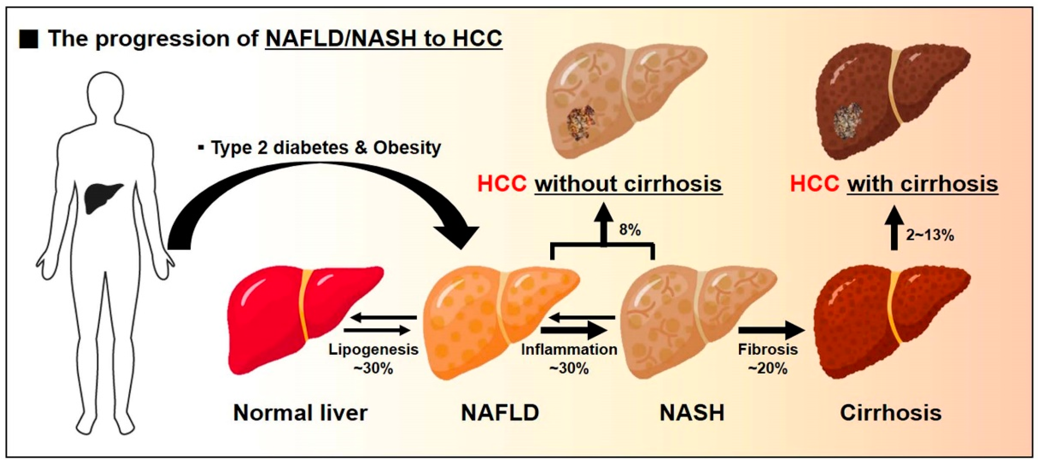 IJMS | Free Full-Text | Metabolic Spectrum of Liver Failure in Type 2  Diabetes and Obesity: From NAFLD to NASH to HCC