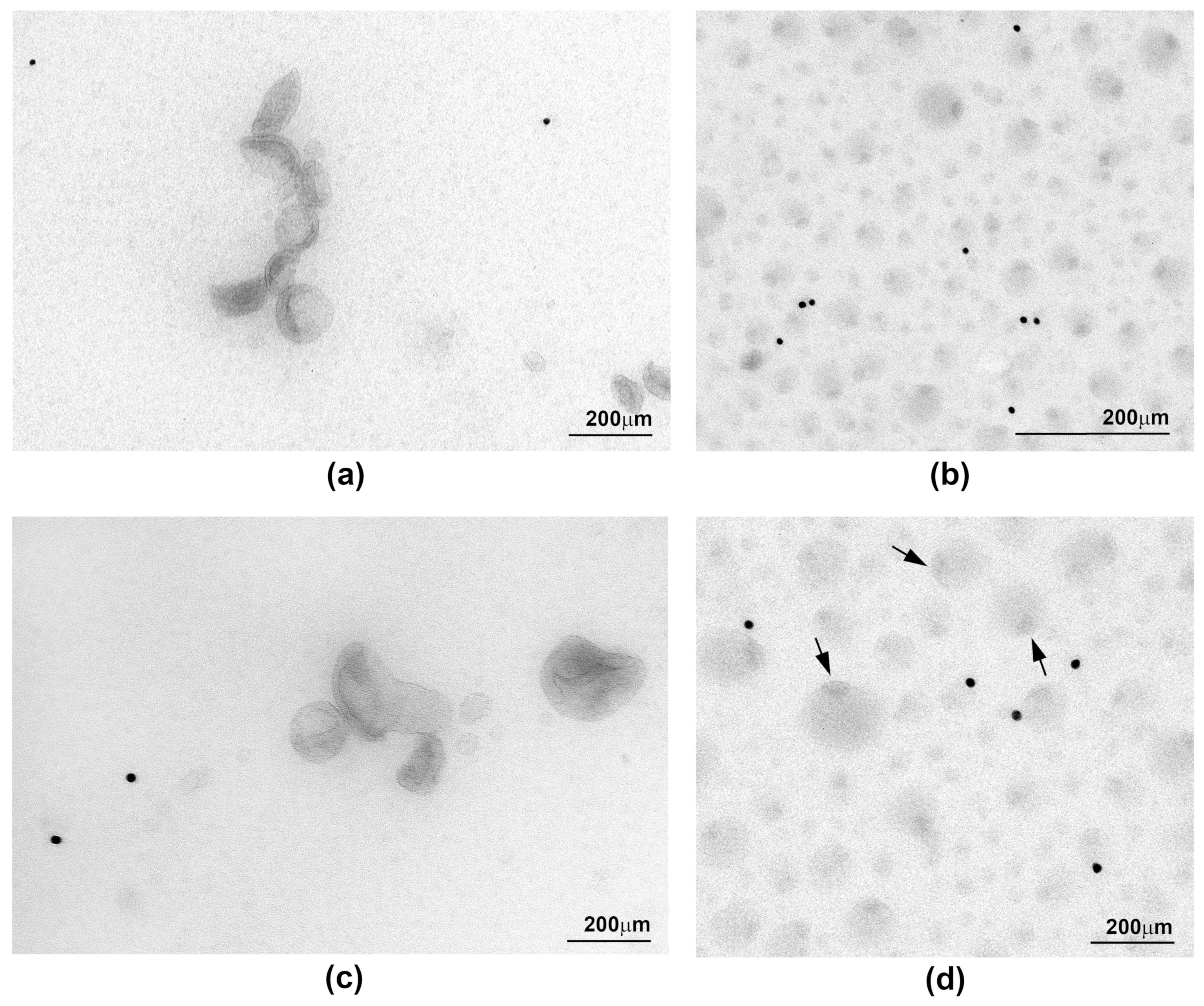Download Ijms Free Full Text Isolation Of Small Extracellular Vesicles From Human Sera Html
