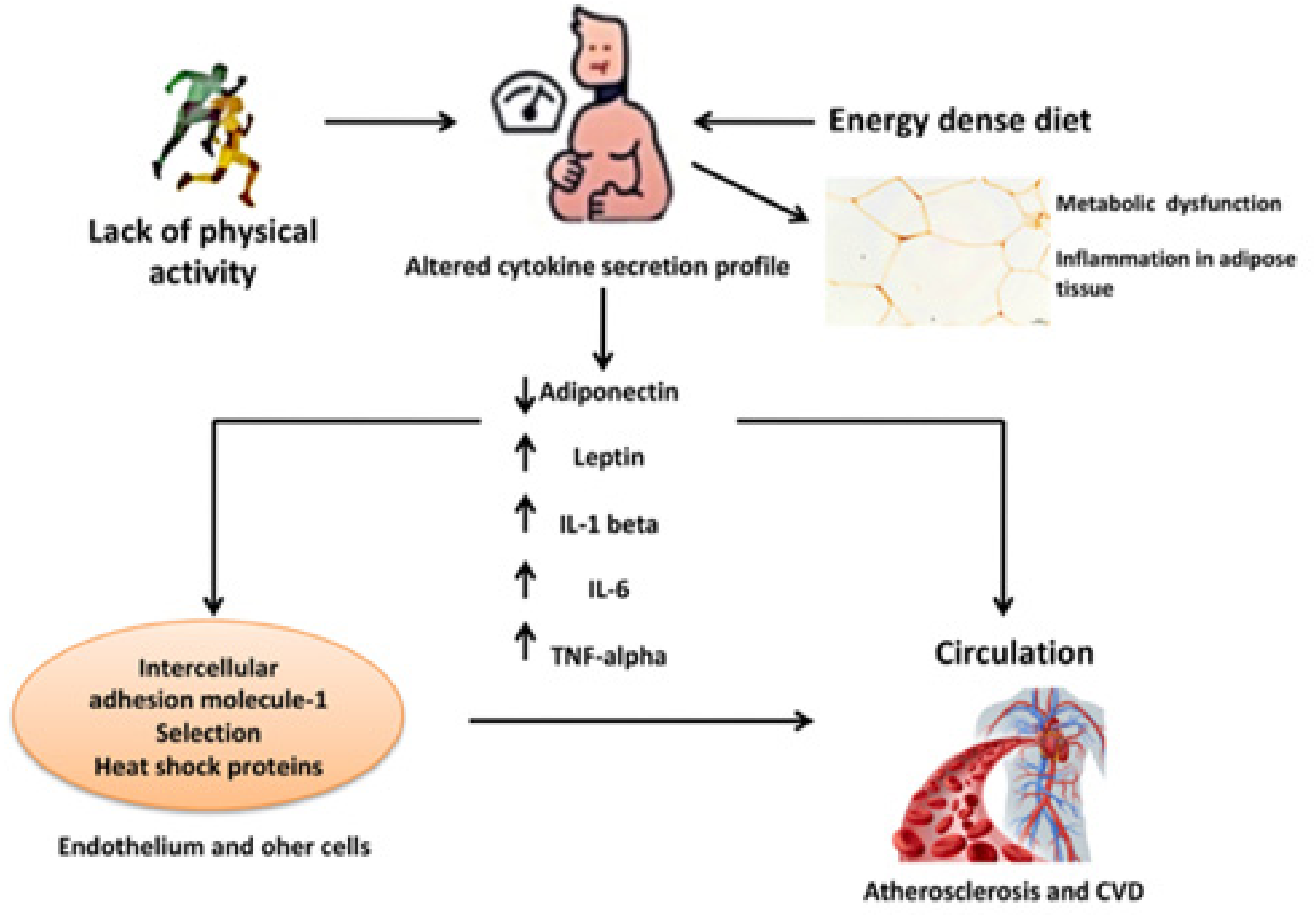 Ijms Free Full Text Impact Of Obesity Induced Inflammation On Cardiovascular Diseases Cvd Html