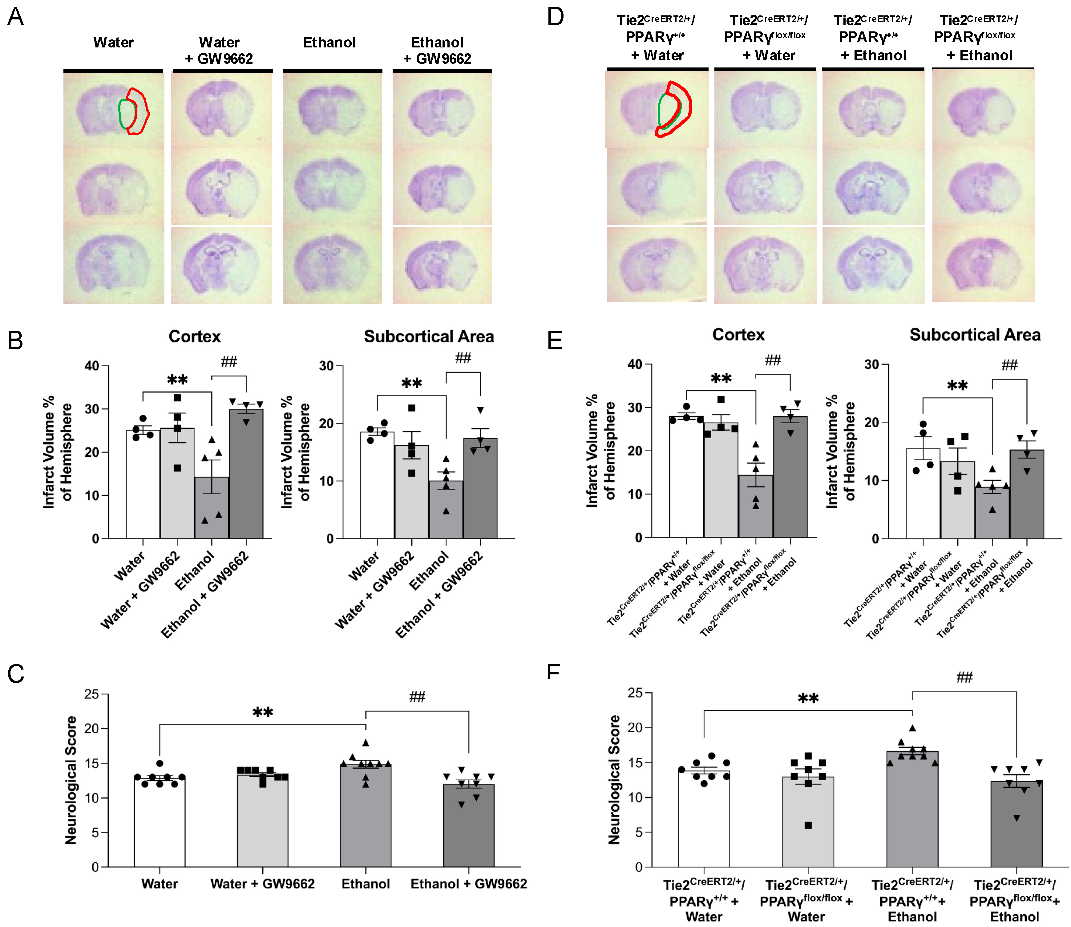 IJMS | Free Full-Text | Chronic Low-Dose Alcohol Consumption Attenuates  Post-Ischemic Inflammation via PPARγ in Mice