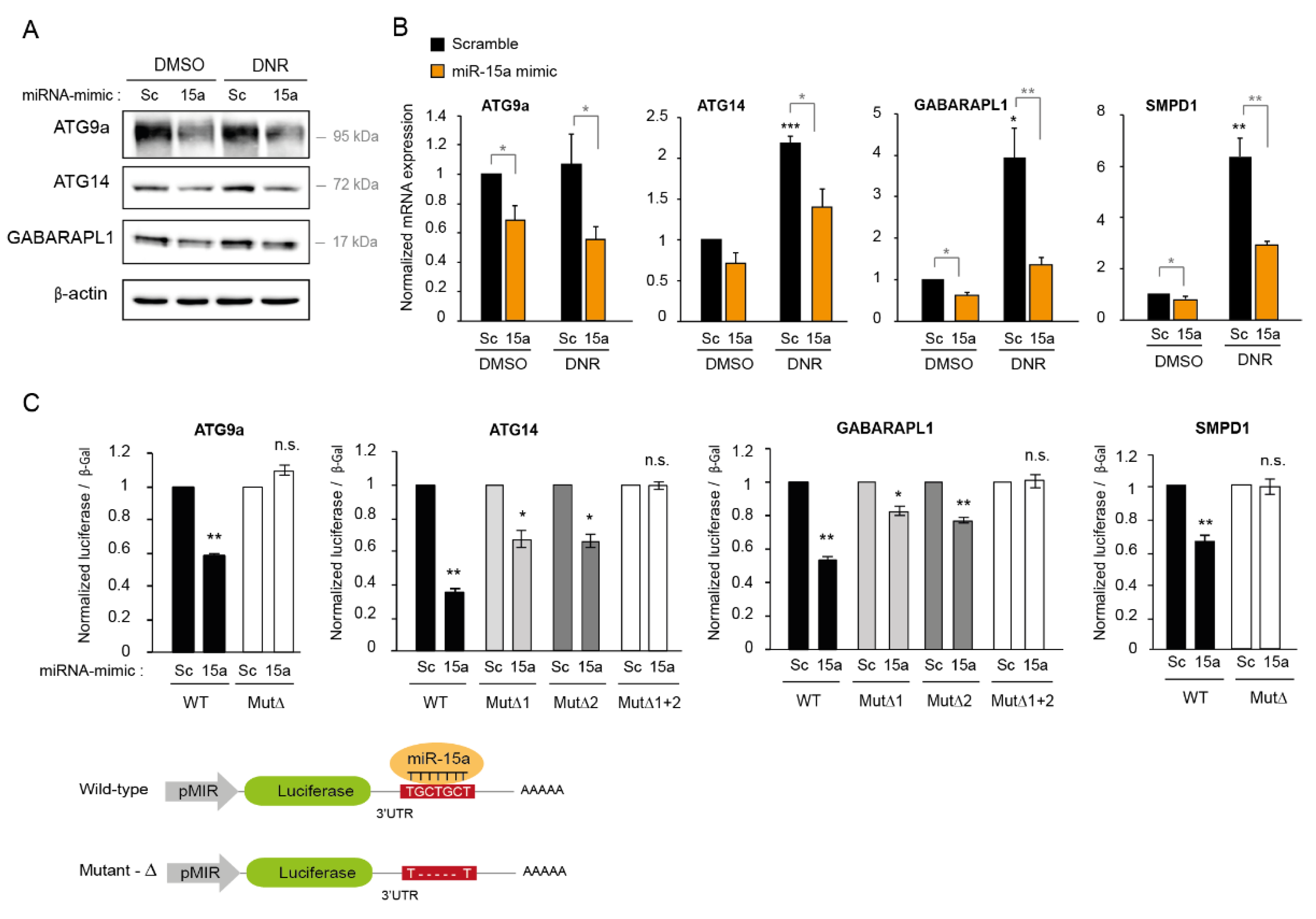 IJMS | Free Full-Text | MiR-15a-5p Confers Chemoresistance in Acute