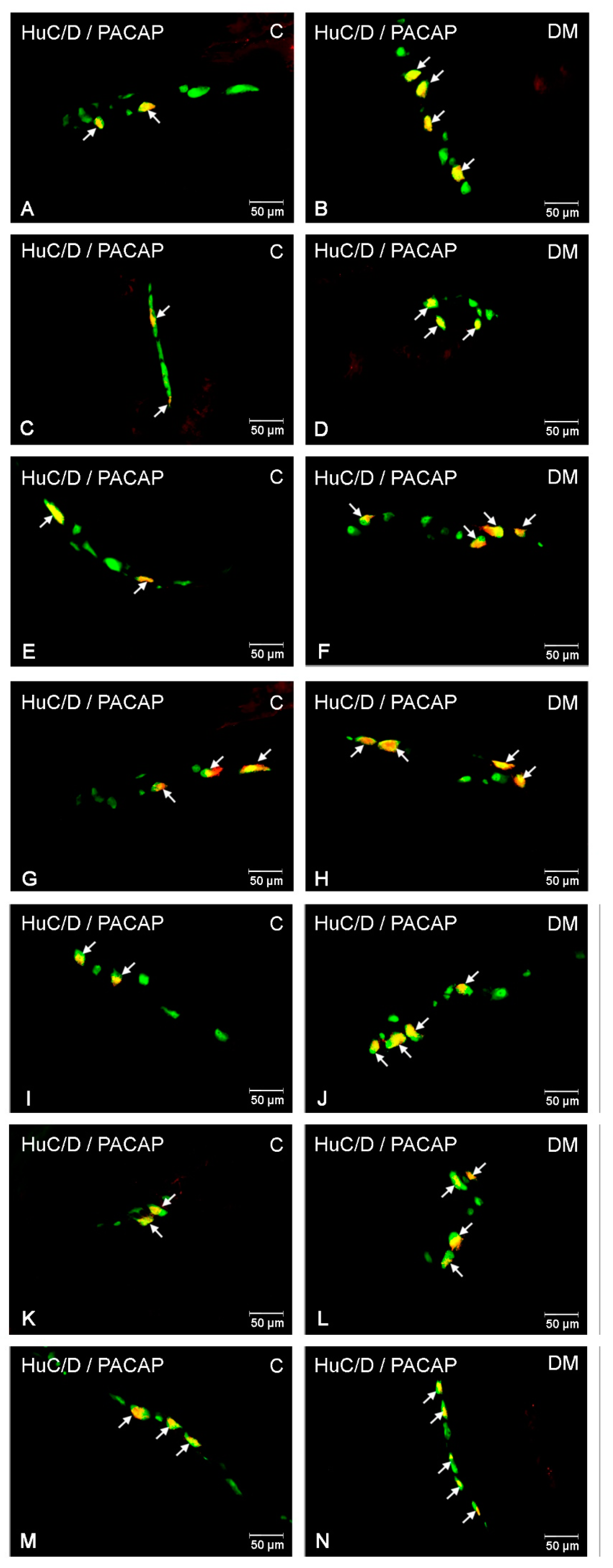 Ijms 22 05727 g004 Ijms 22 05727 g004