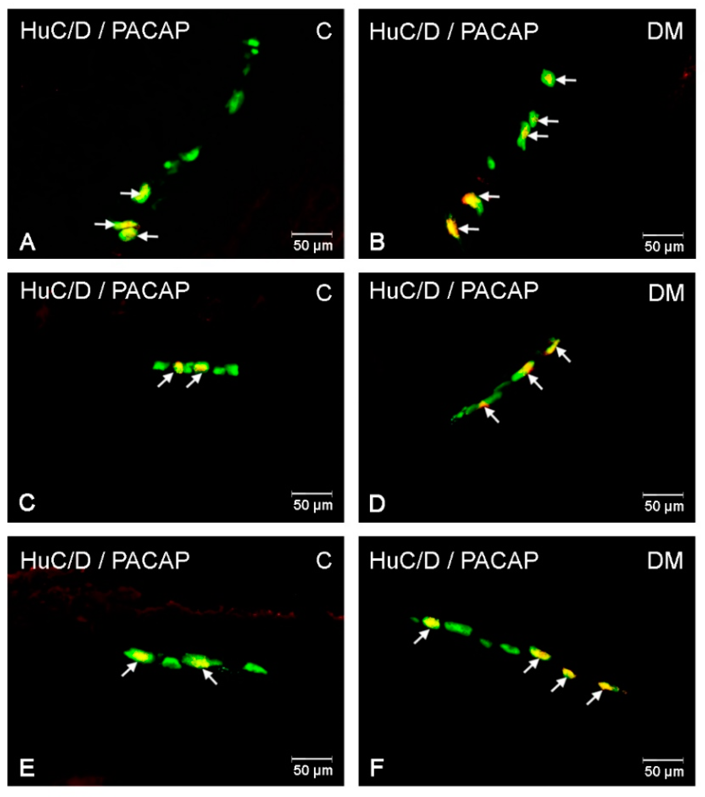 Ijms 22 05727 g005 Ijms 22 05727 g005