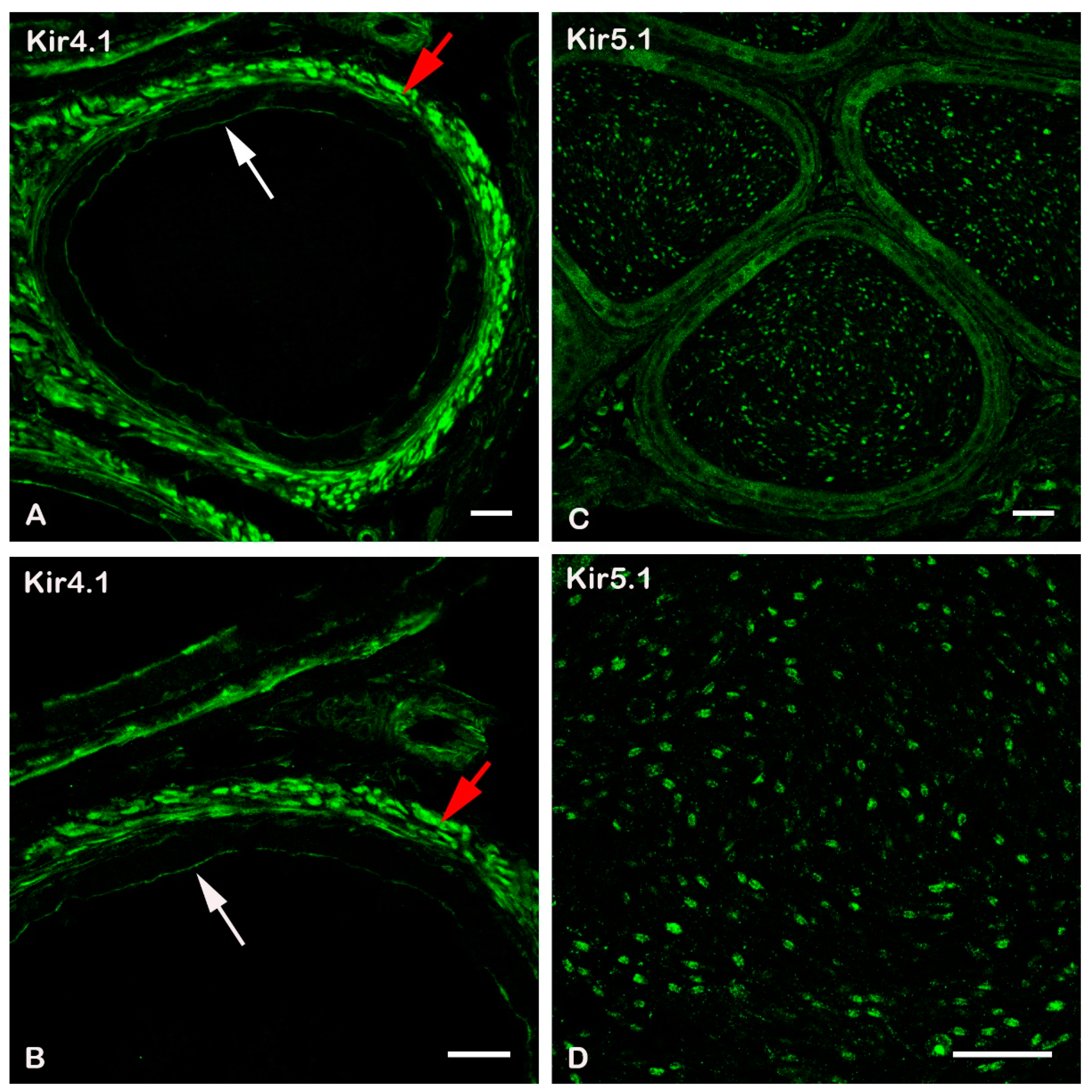 IJMS | Free Full-Text | Kcnj16 (Kir5.1) Gene Ablation Causes Subfertility  and Increases the Prevalence of Morphologically Abnormal Spermatozoa