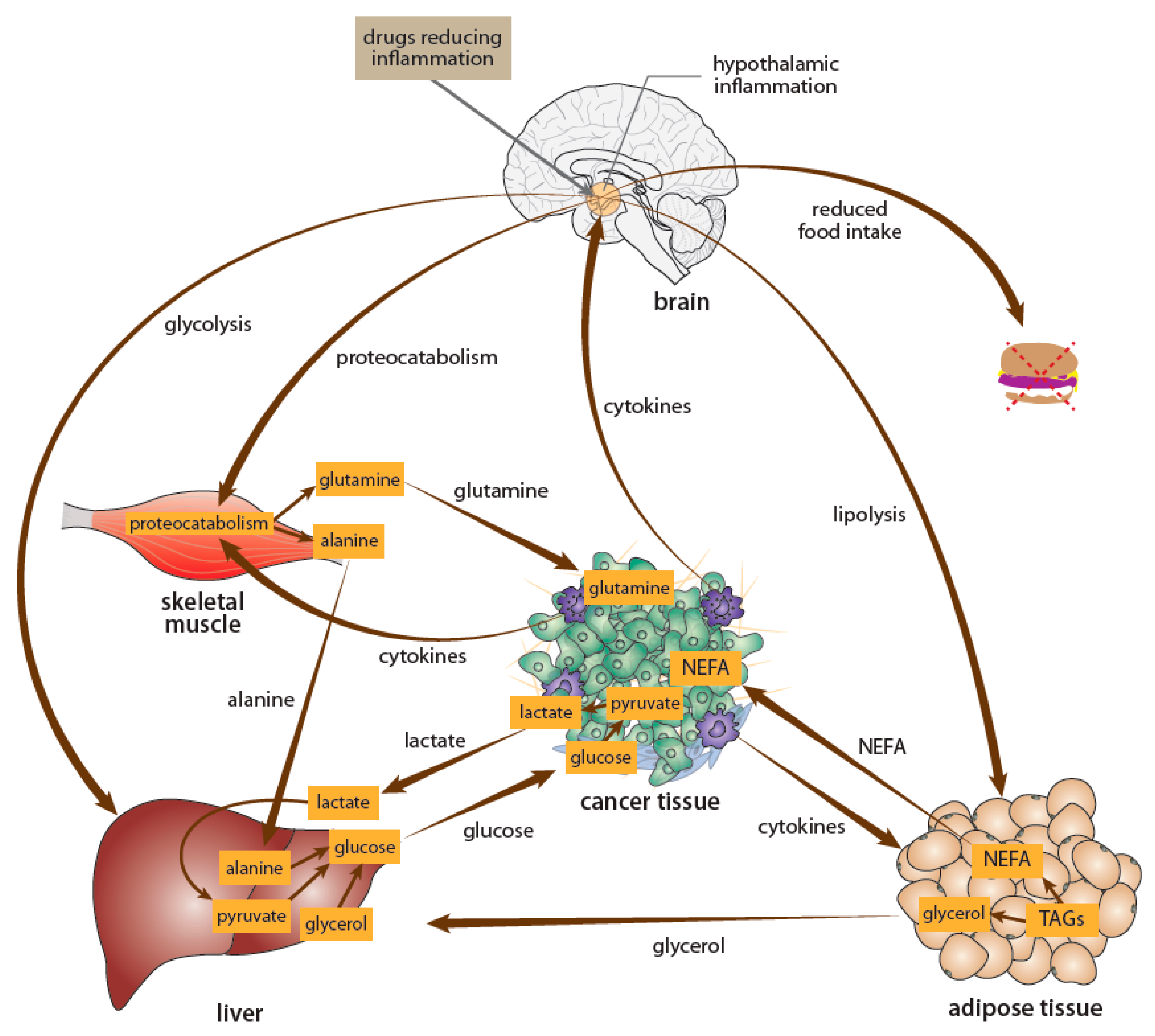 IJMS | Free Full-Text | Neurobiology of Cancer: Introduction of 