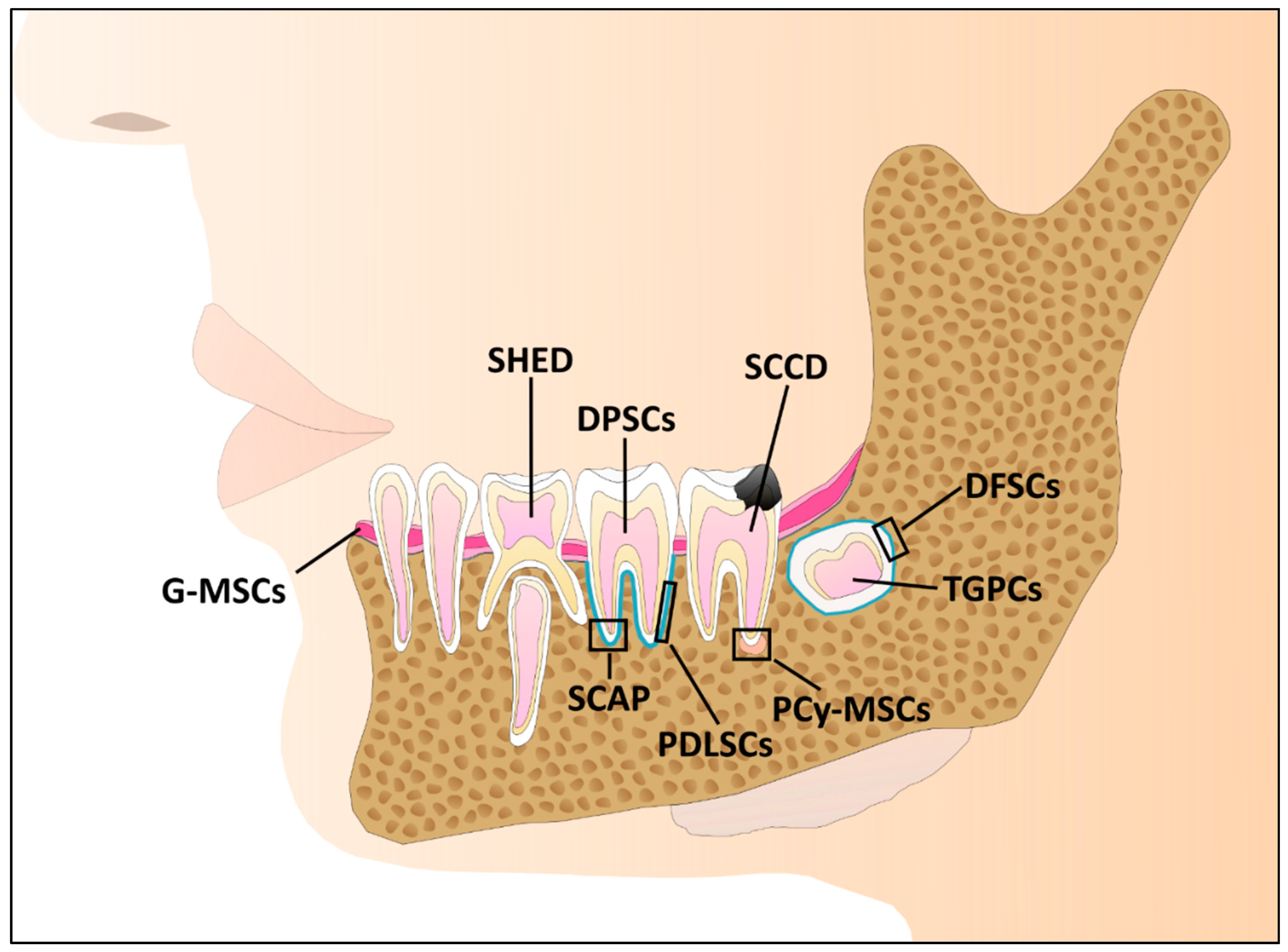 IJMS | Free Full-Text | Sinking Our Teeth in Getting Dental Stem Cells to  Clinics for Bone Regeneration