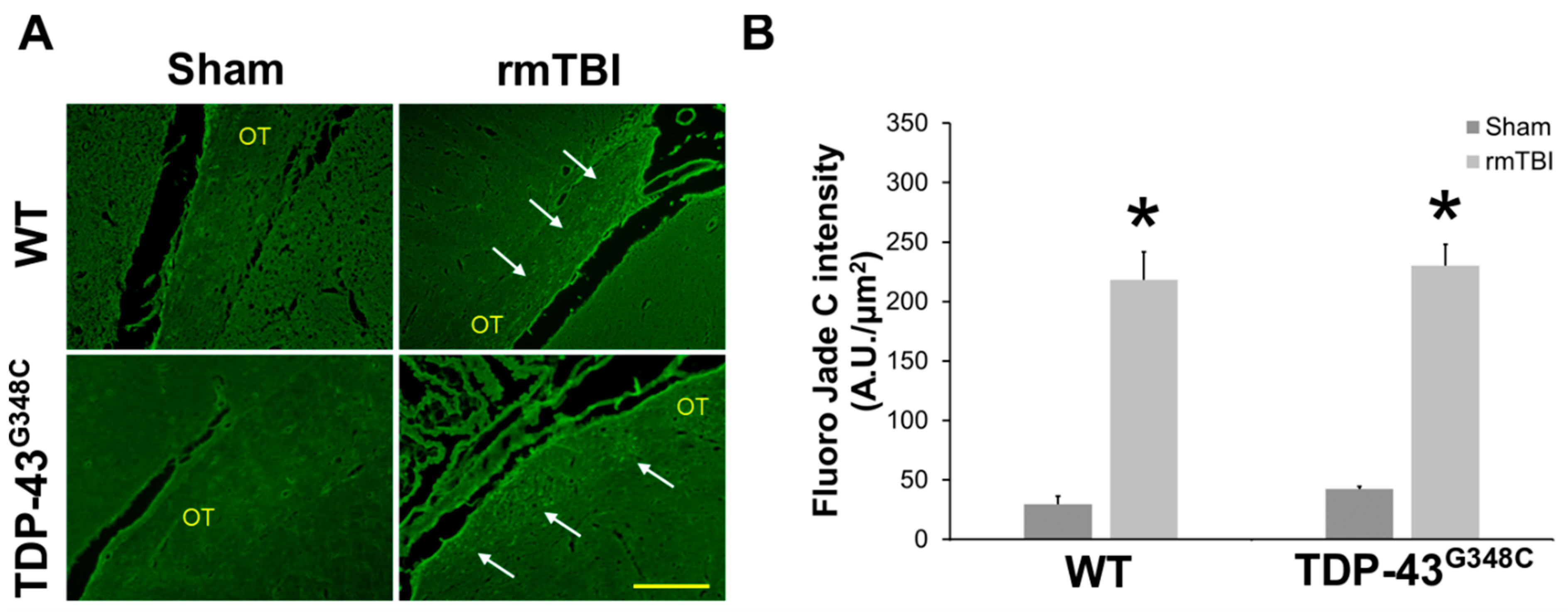 IJMS | Free Full-Text | Long-Term Effects of Repetitive Mild Traumatic  Injury on the Visual System in Wild-Type and TDP-43 Transgenic Mice