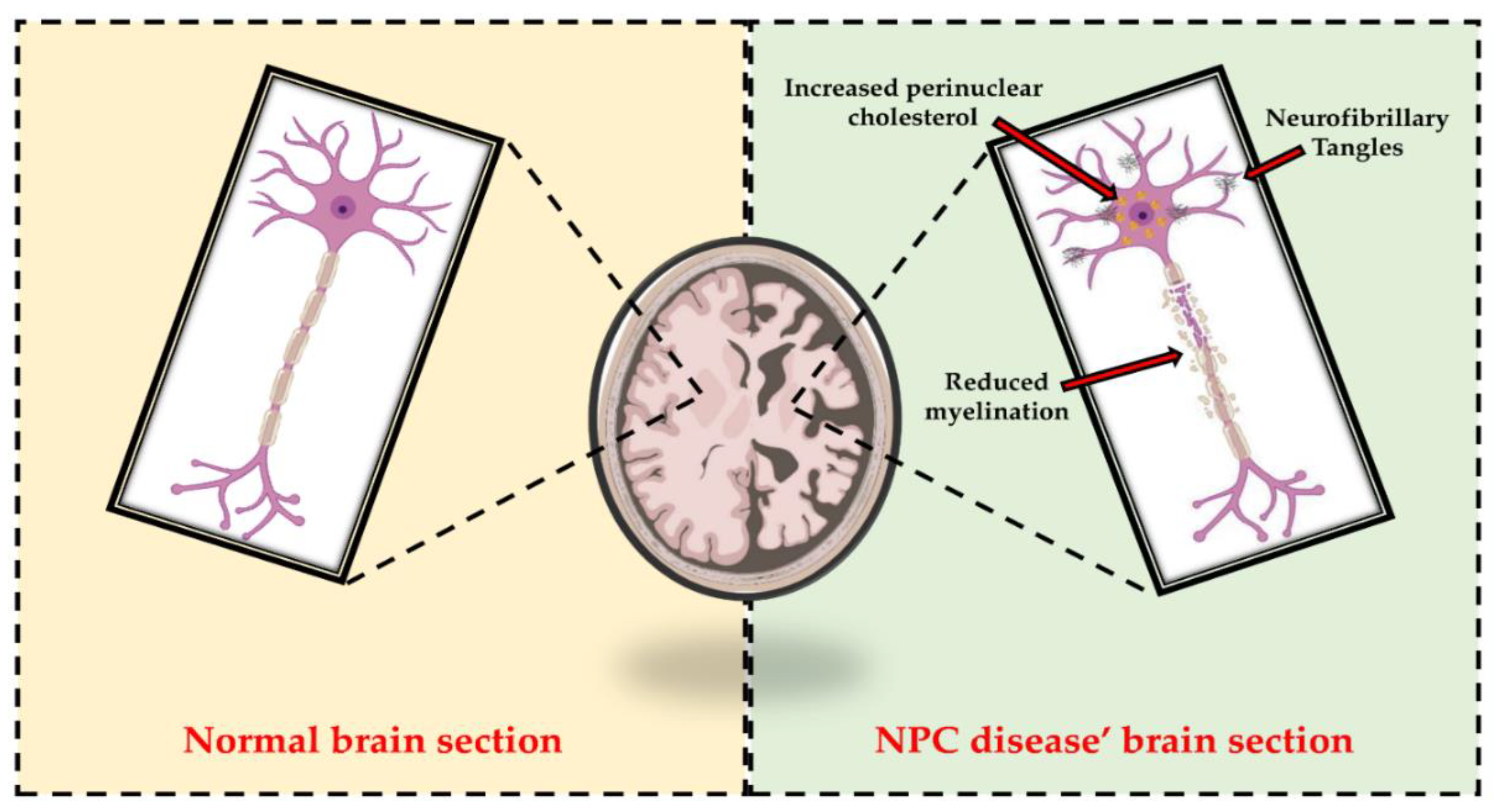 Niemann–Pick type C disease: cellular pathology and