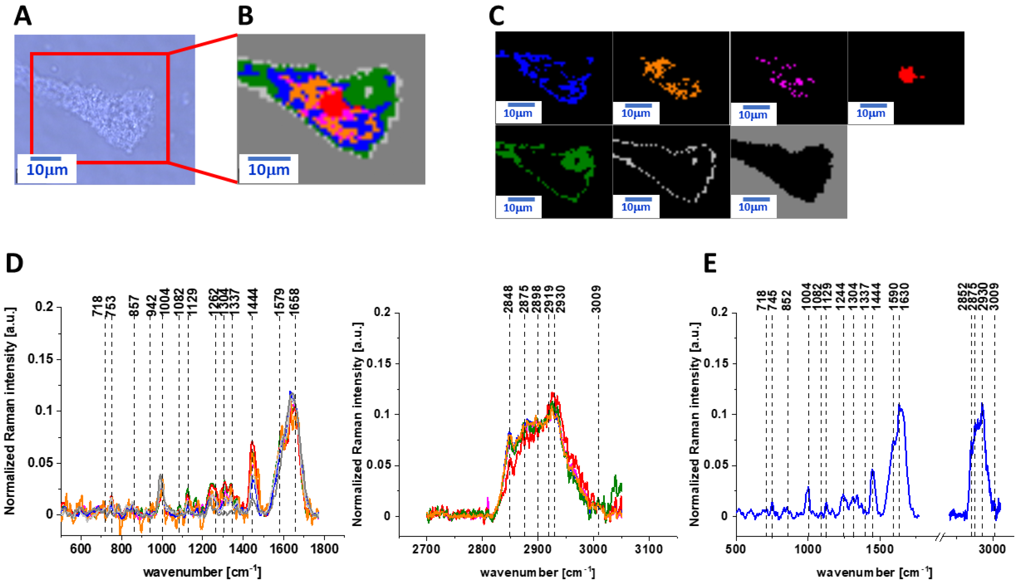 Ijms Free Full Text Vitamin C Protective Role In Oxidative Stress Conditions Induced In Human Normal Colon Cells By Label Free Raman Spectroscopy And Imaging Html